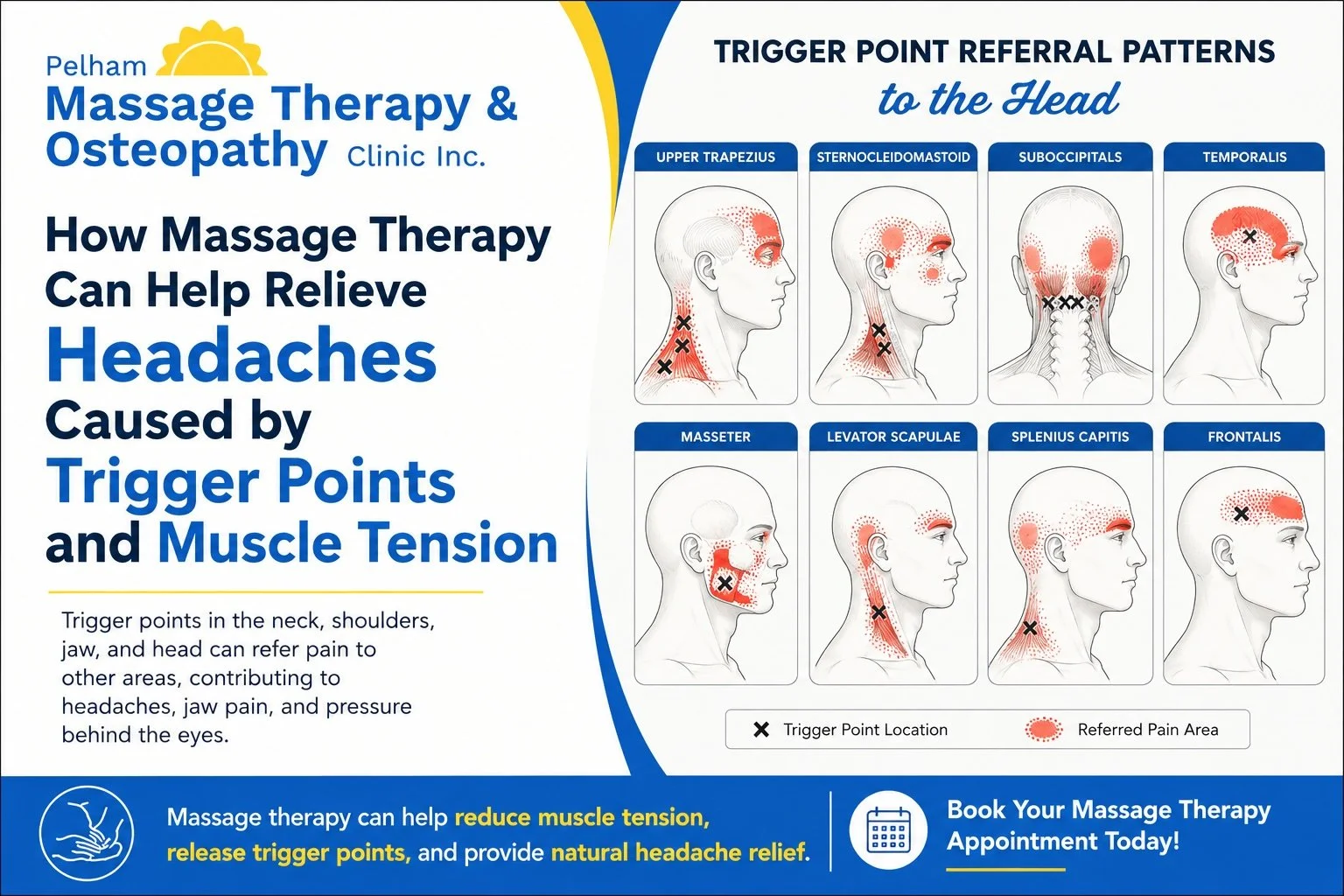 Massage Therapy for Tension Headaches: How It Can Help