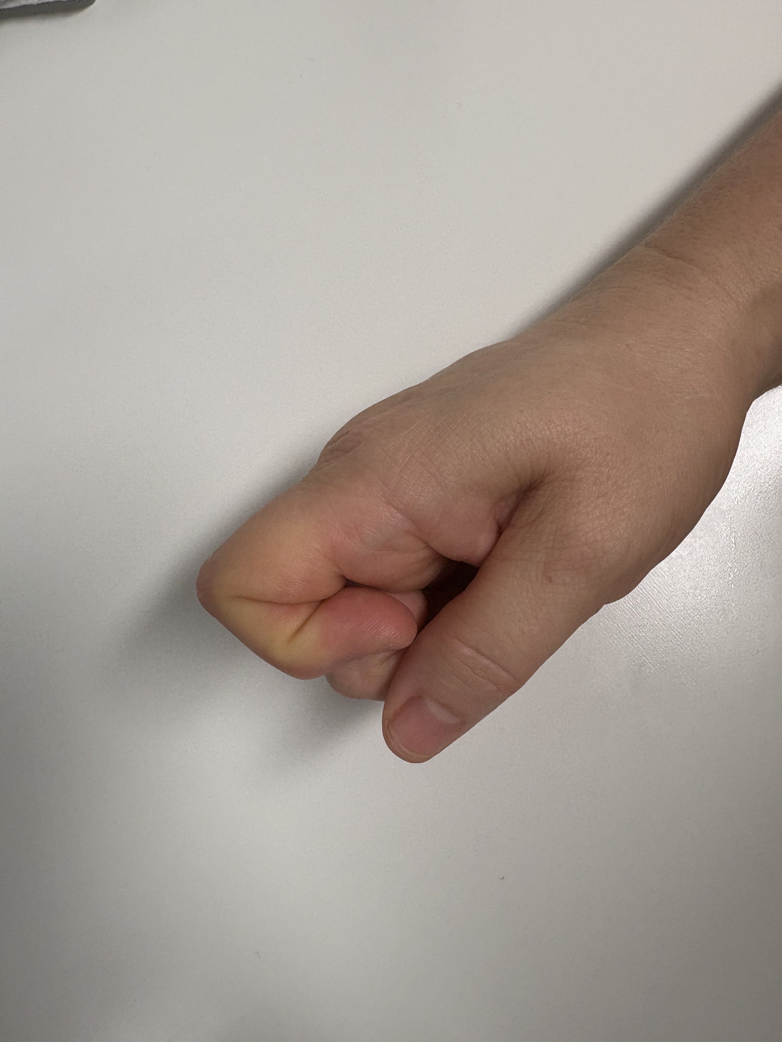 finger-bend-exercise-bent.jpg