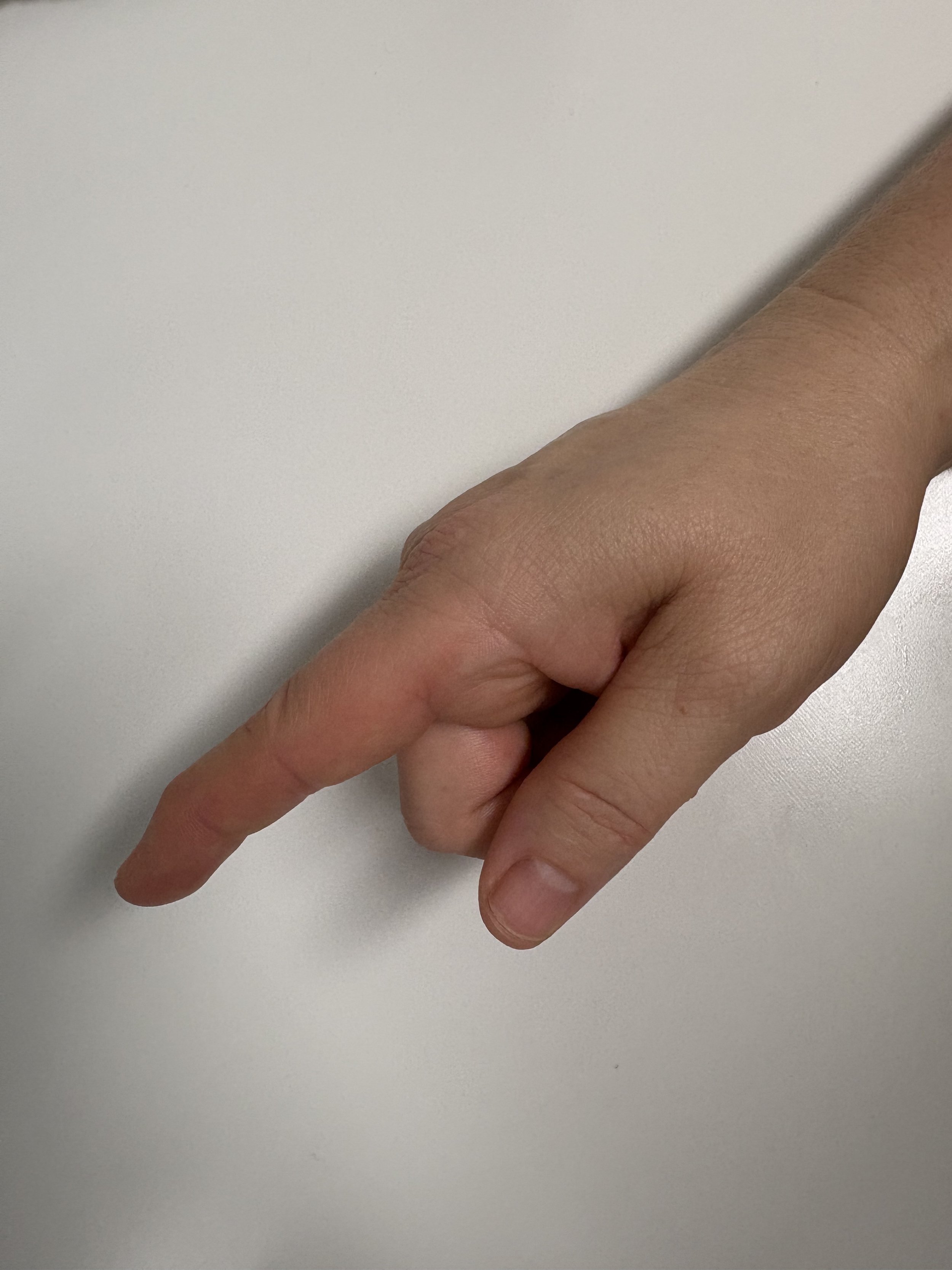 Finger Bend Exercise