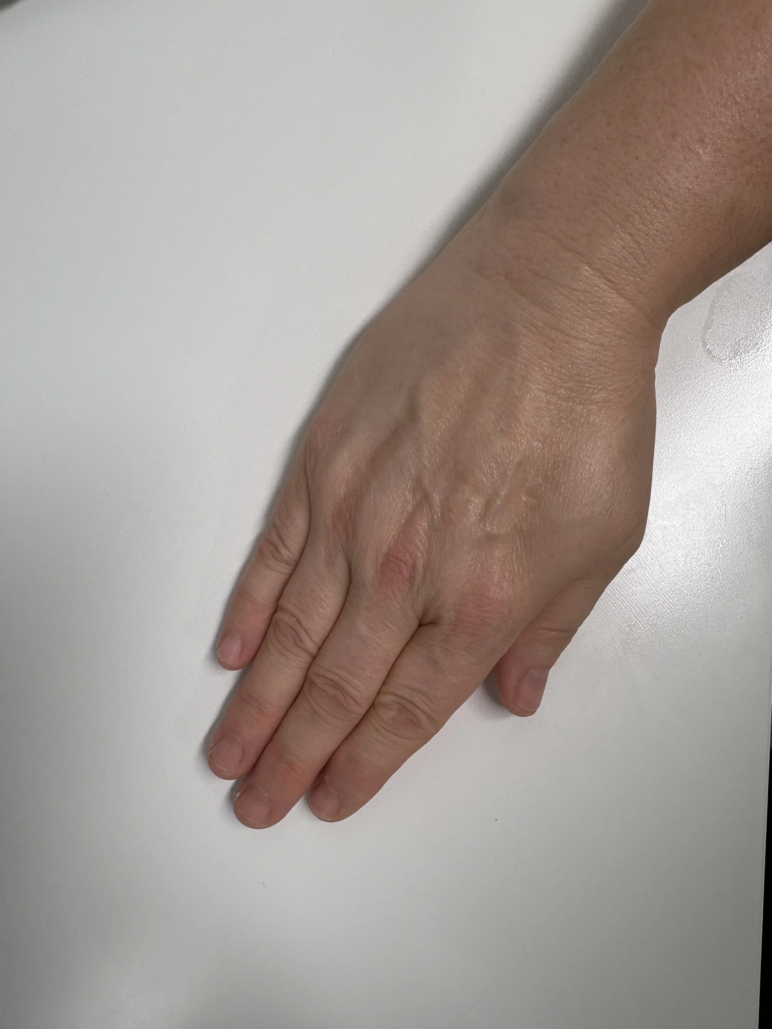 wrist-deviation-exercise-start.jpg