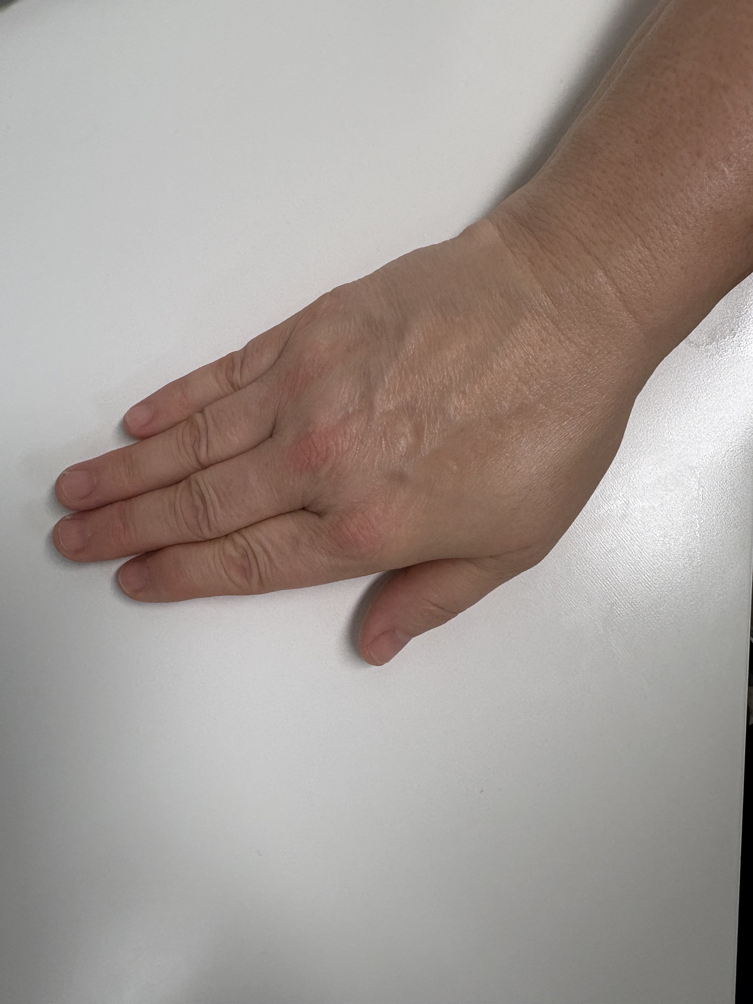wrist-deviation-exercise-neurtal.jpg