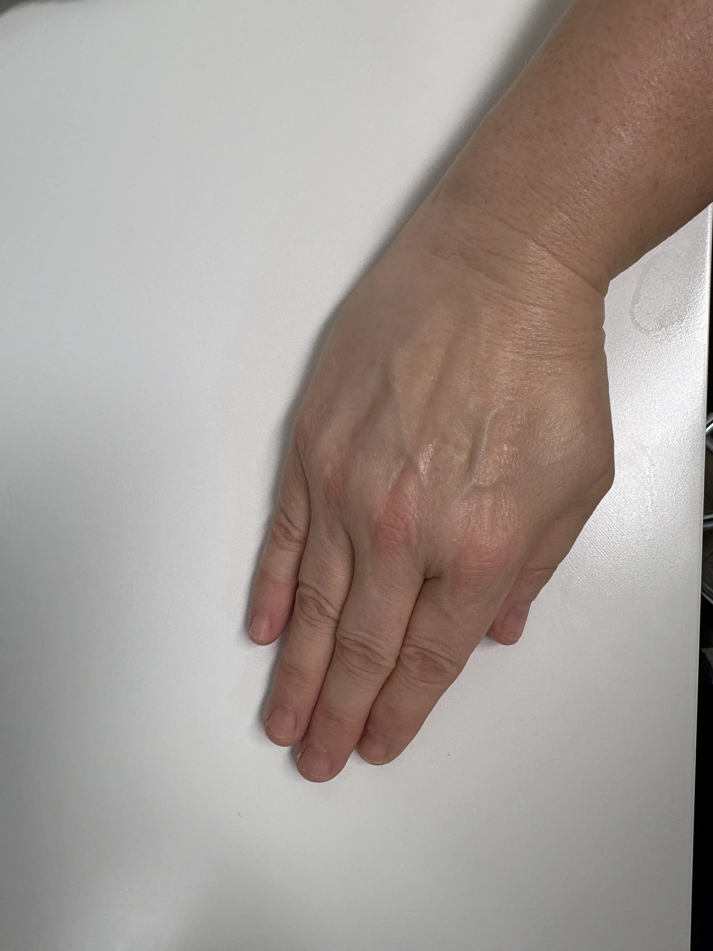 wrist-deviation-exercise-end.jpg