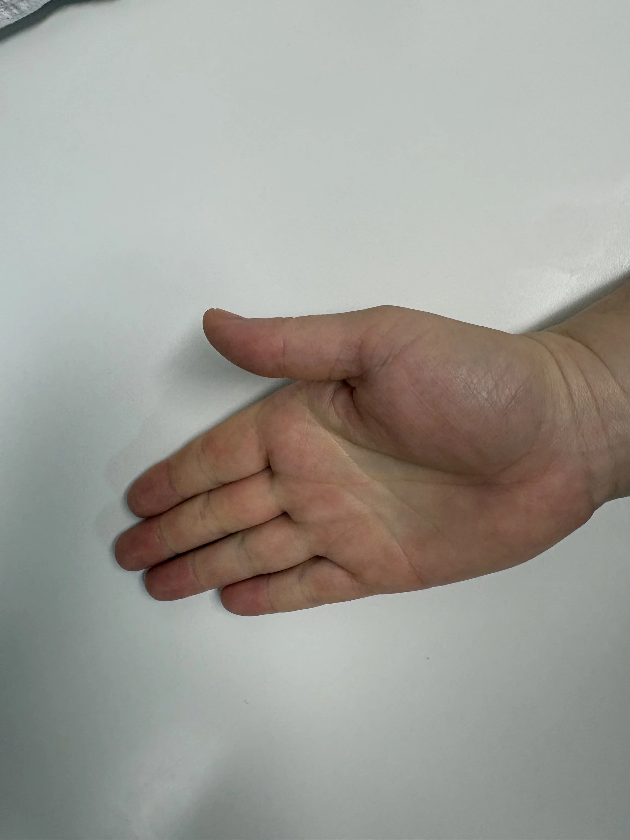 hand-clench-exercise-start.jpg