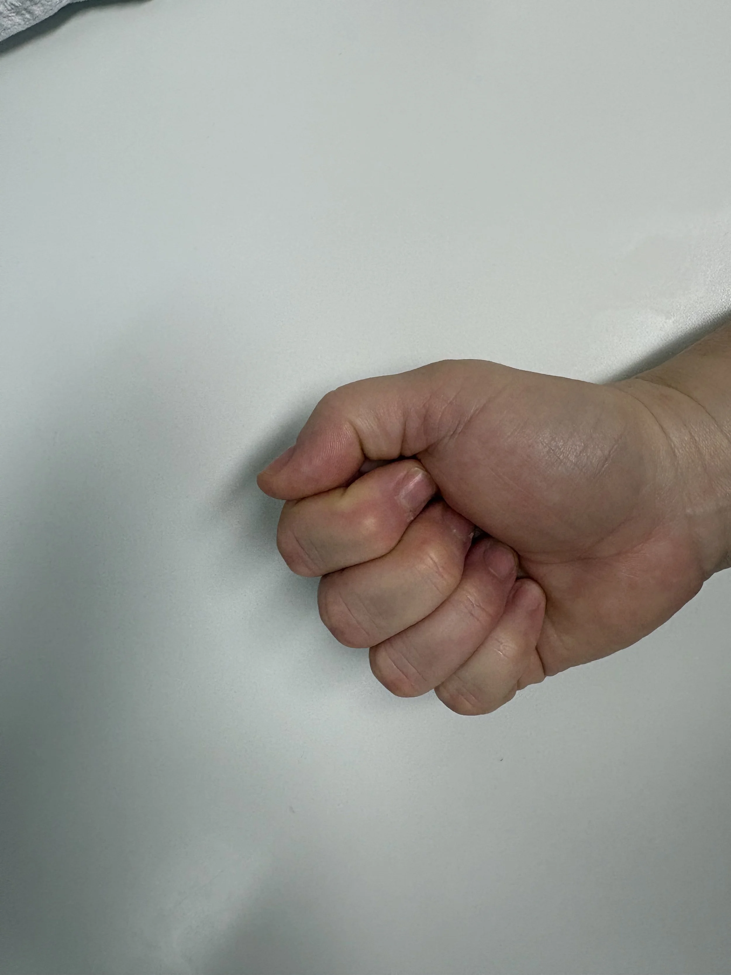 Hand Clench Exercise