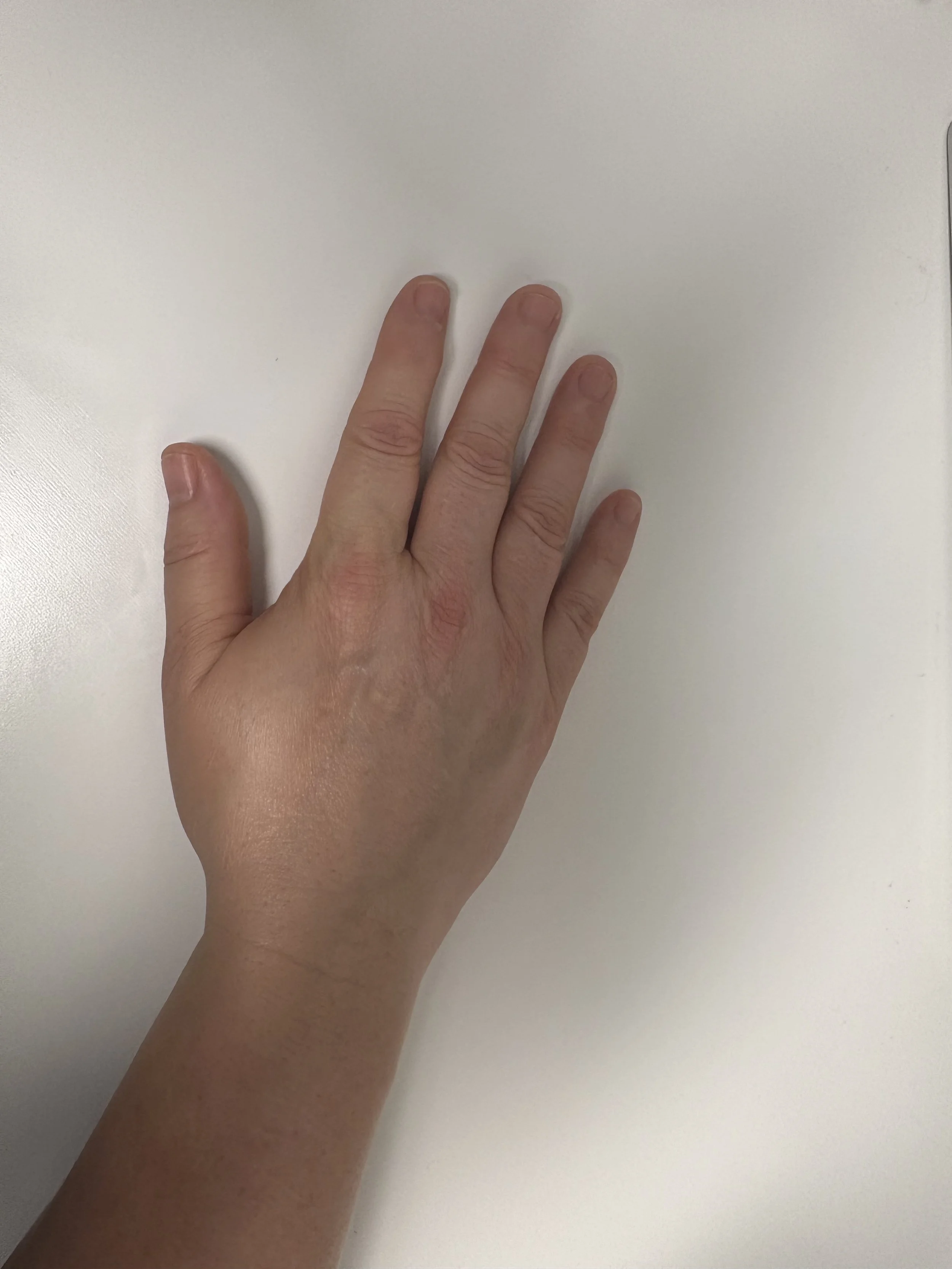 finger-extension-exercise-end.jpg