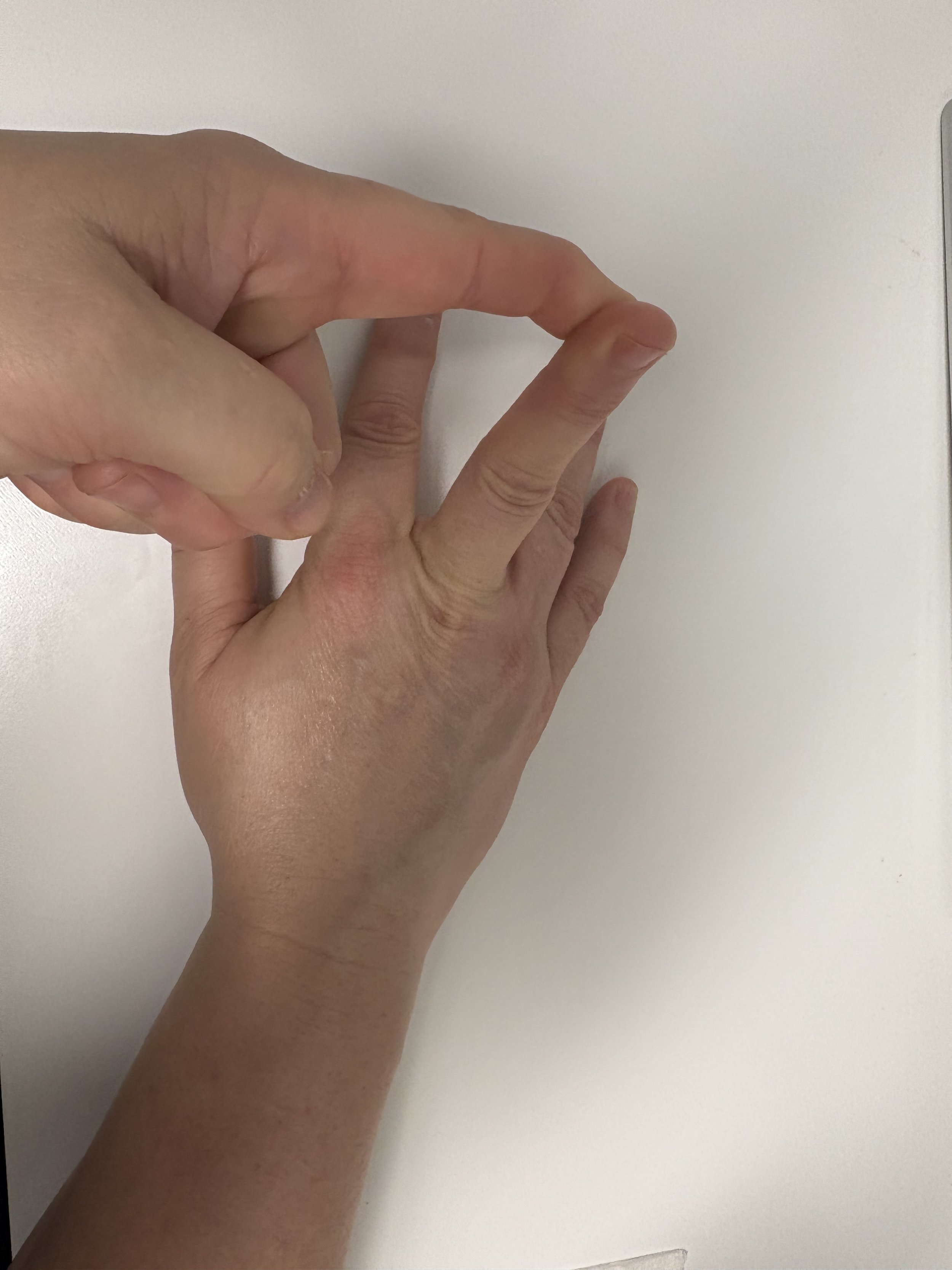 Finger Extension Exercise 