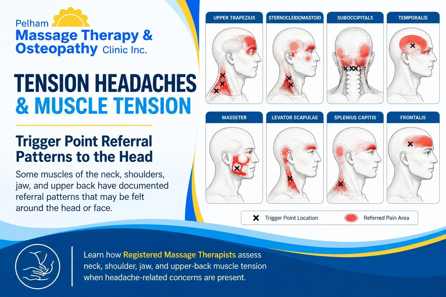 nfographic showing trigger point referral patterns from neck, shoulder, jaw, and upper-back muscles that may be felt around the head or face, with educational Massage Therapy information from Pelham Massage Therapy & Osteopathy Clinic in Fonthill.
