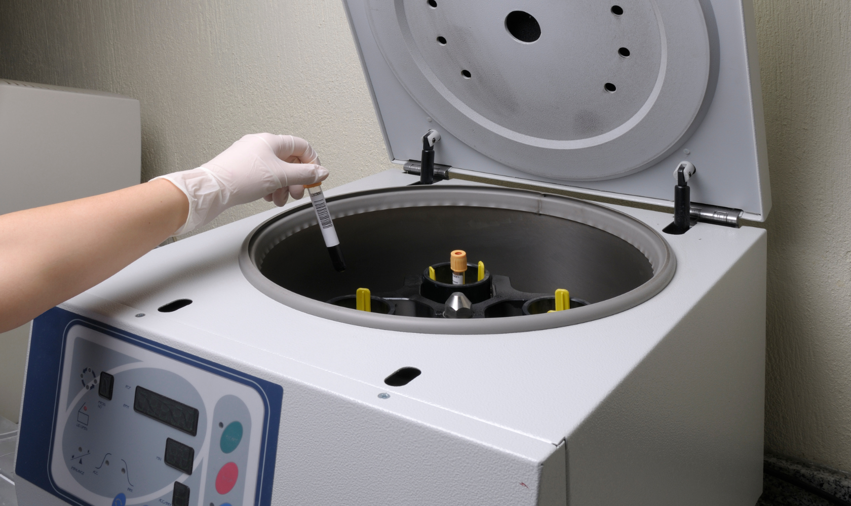 A person wearing gloves handling a blood sample in a vial in a laboratory centrifuge machine. Boost collagen with PRP microneedling. Treat fine lines, acne scars & texture for radiant skin. Skin Affair Med Spa | Clovis CA Aesthetic Experts