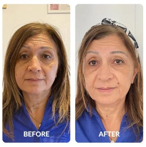 WhatsApp Image 2026-04-05 at 15.51.57 (8).jpeg