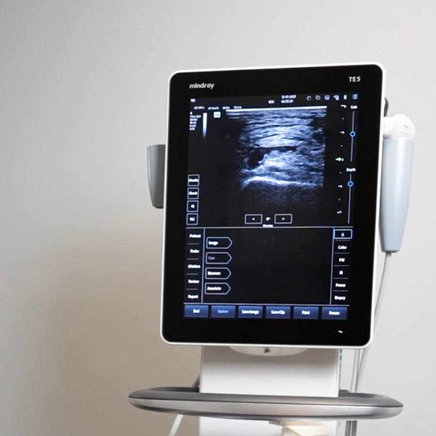 Medical professional administering an ultrasound scan on a patient's abdomen while another healthcare worker observes the monitor displaying the ultrasound image.