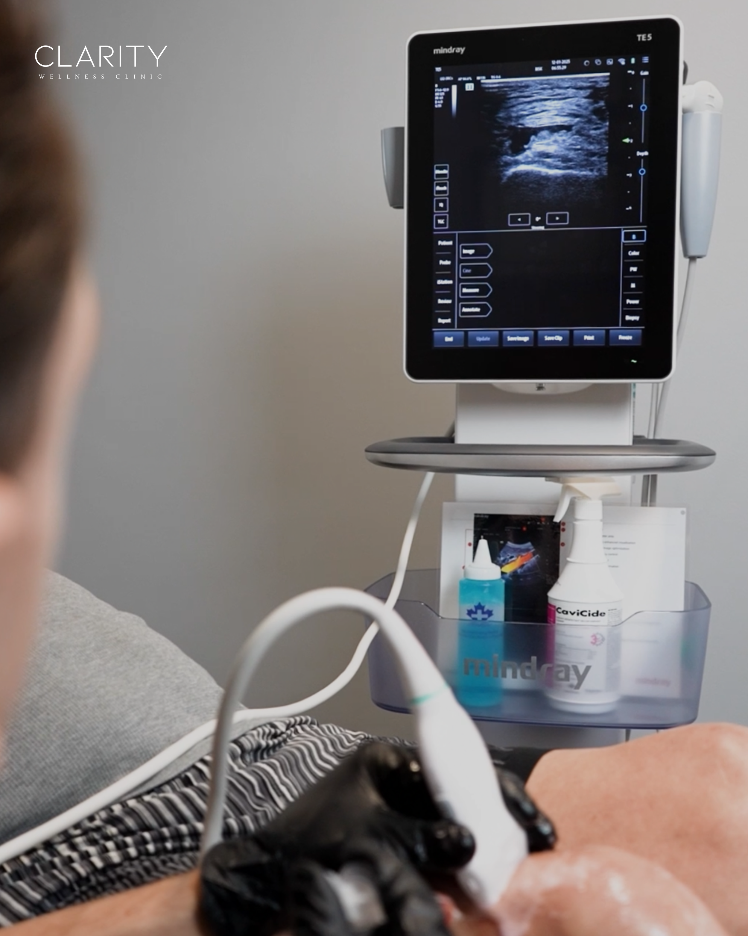 A medical ultrasound monitor displaying an ultrasound scan, with a patient lying down in the foreground and medical supplies on a cart below.