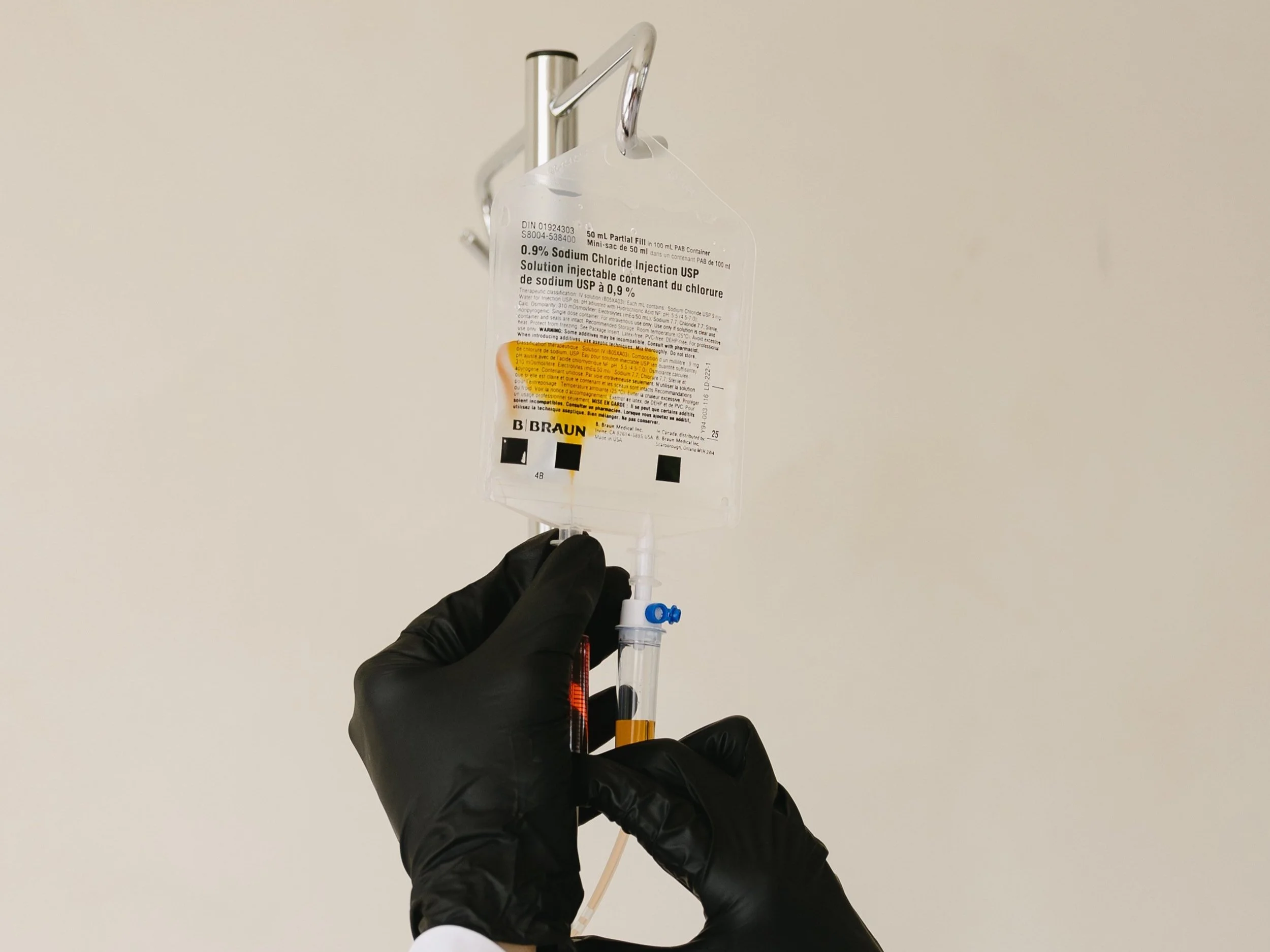 A healthcare worker wearing black gloves holding an IV bag containing a yellow-orange liquid and connected to a syringe with a tube in a medical setting.