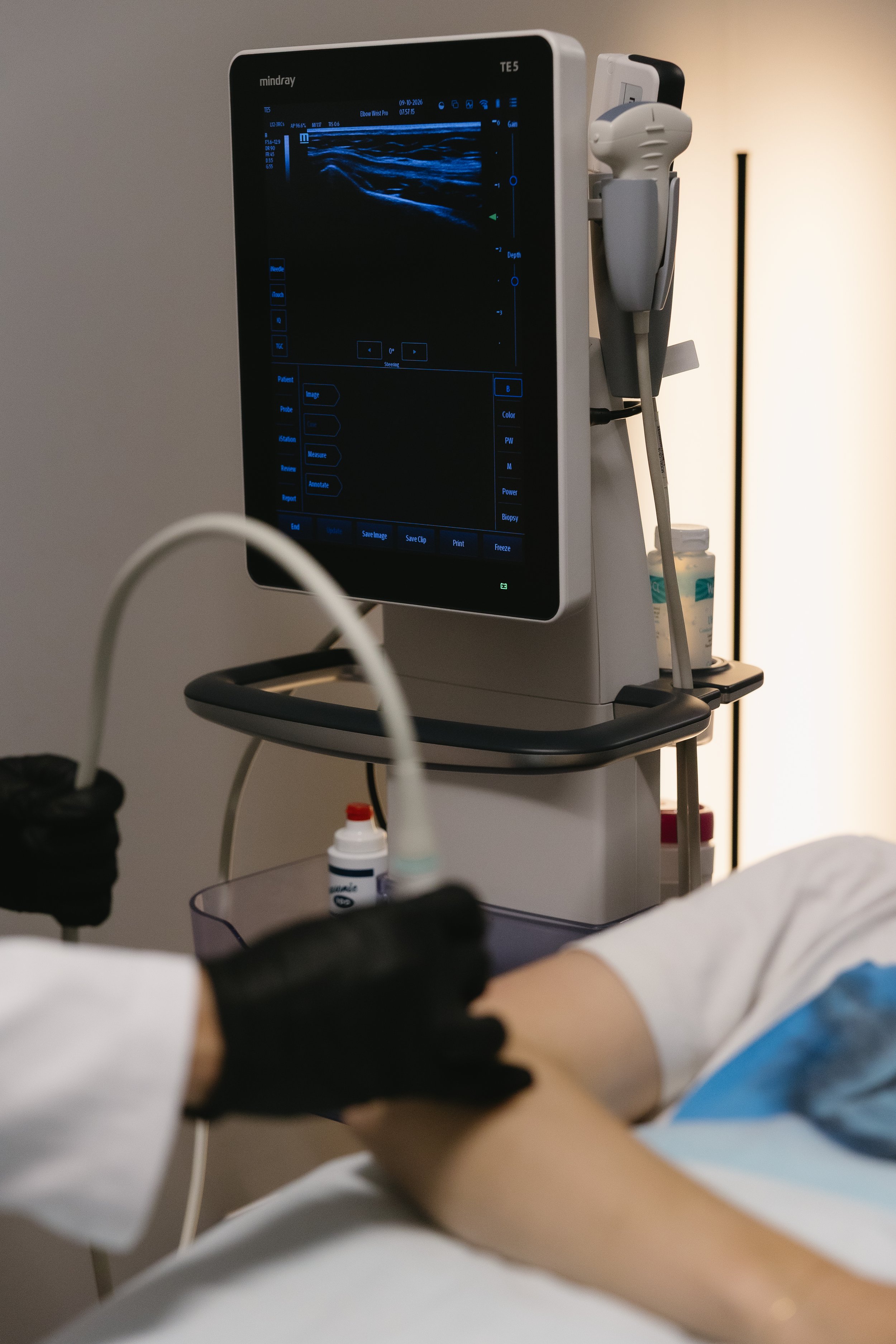 Medical professional administering an ultrasound scan on a patient's abdomen while another healthcare worker observes the monitor displaying the ultrasound image.