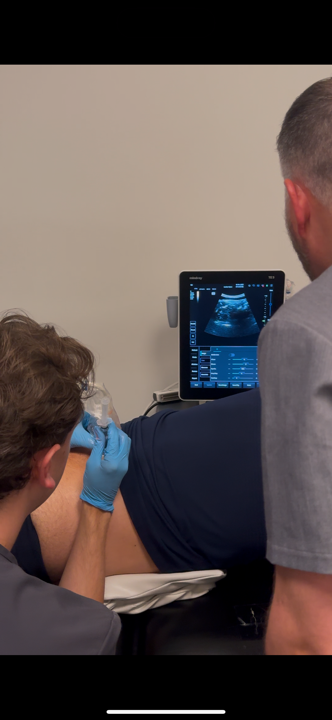 Medical professional administering an ultrasound scan on a patient's abdomen while another healthcare worker observes the monitor displaying the ultrasound image.