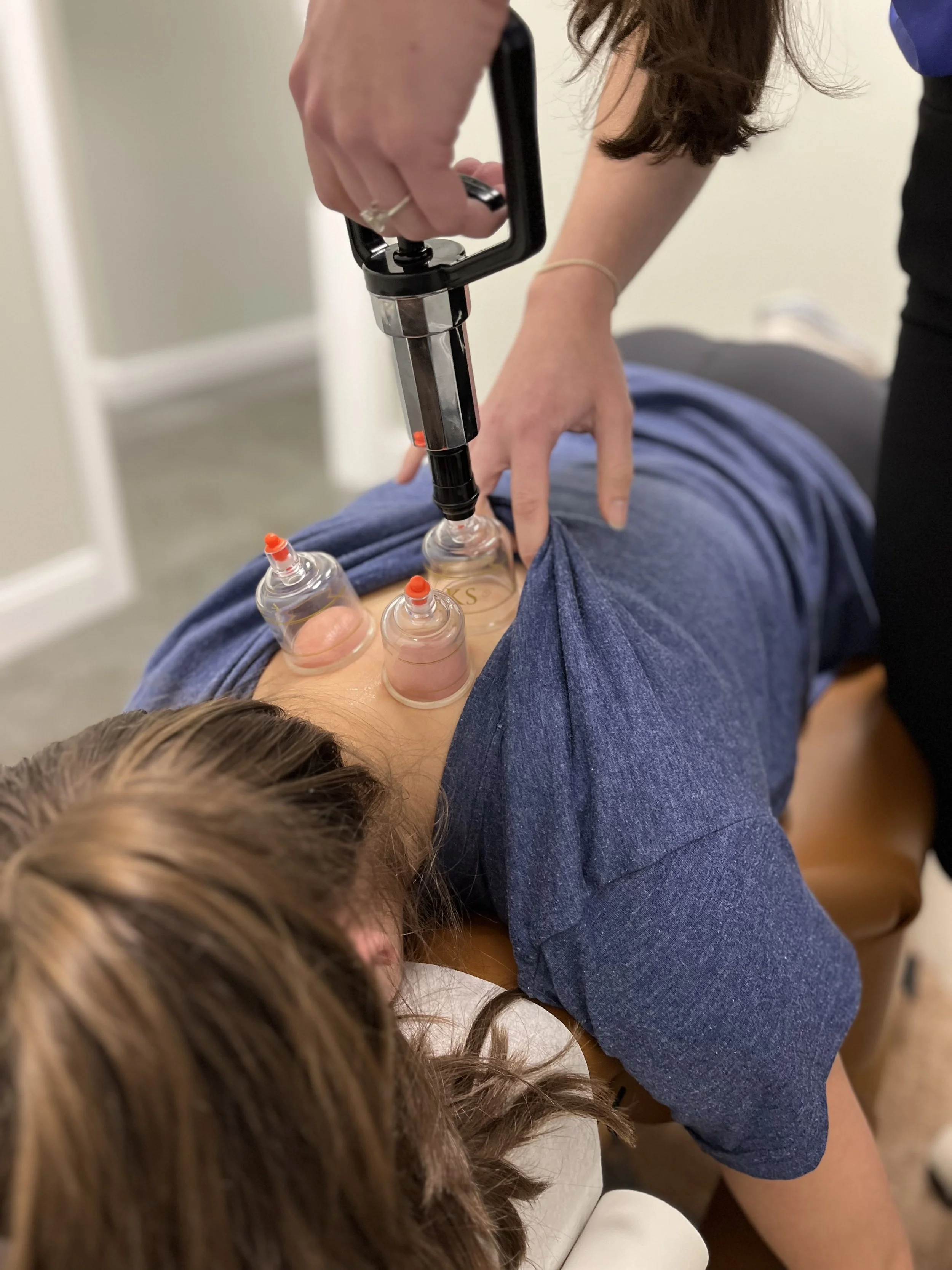 A person lying on their side receives a treatment with a cupping device on their back, with glass cups and a pump to create suction.