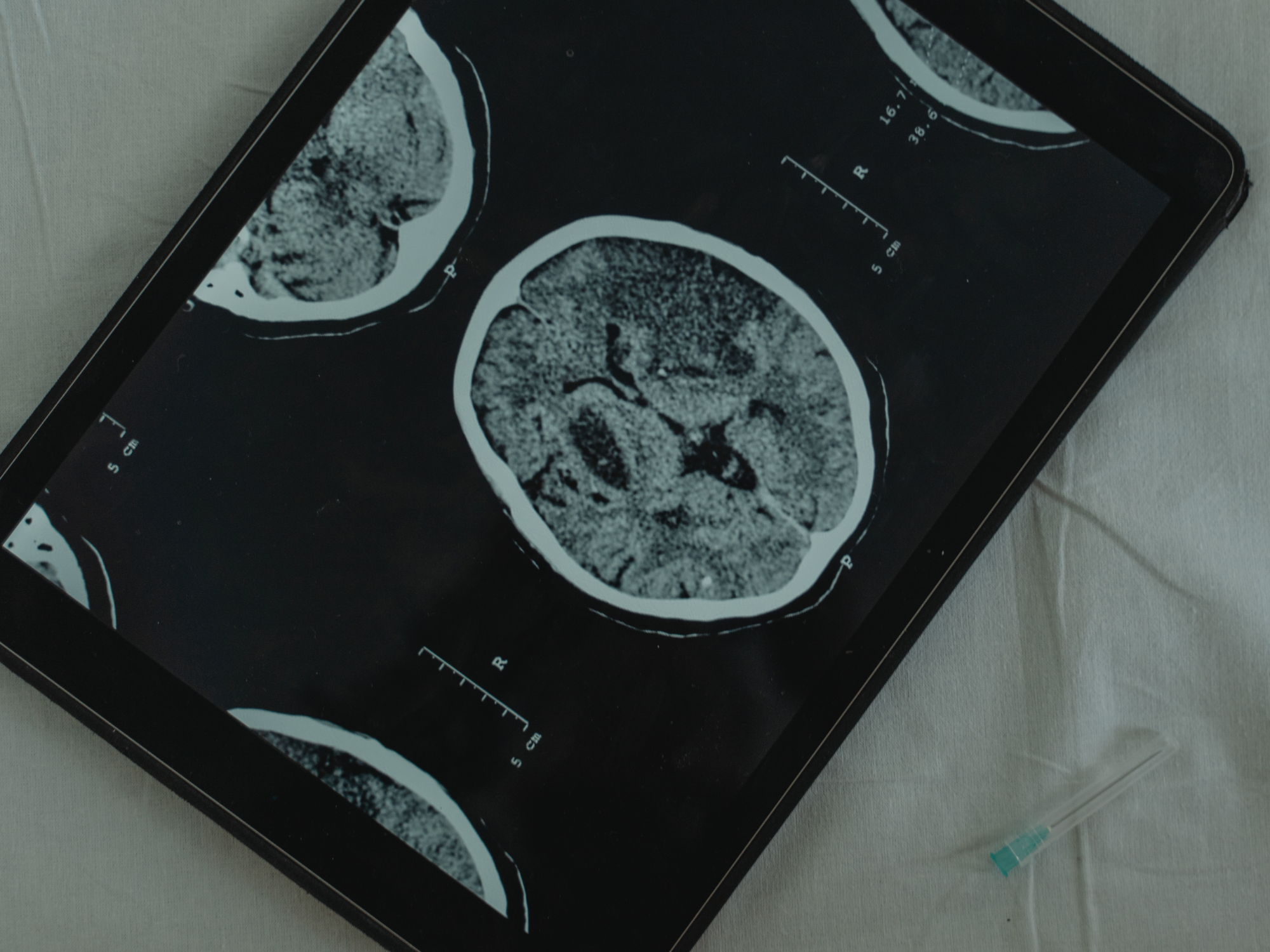 Medical scan of a brain displayed on a tablet screen with an injection syringe beside it.