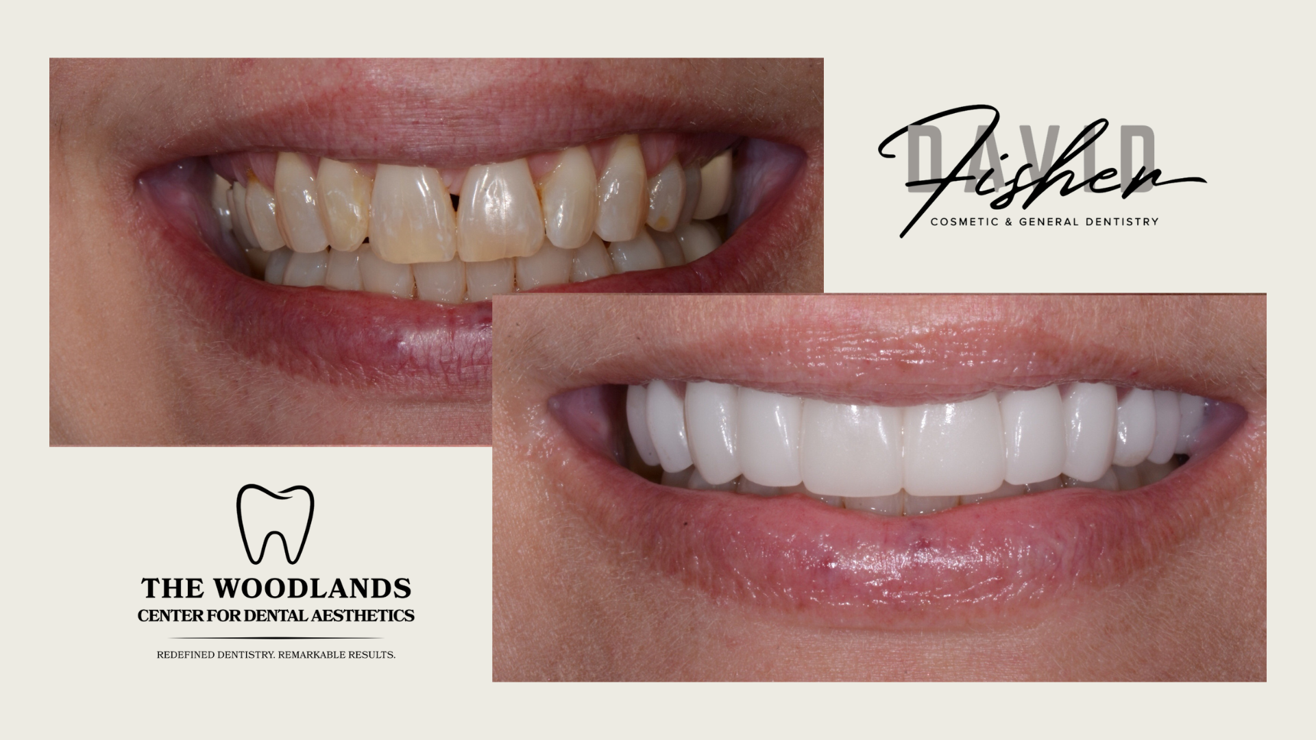 Why "Cosmetic Dentistry" Isn't Just Vanity