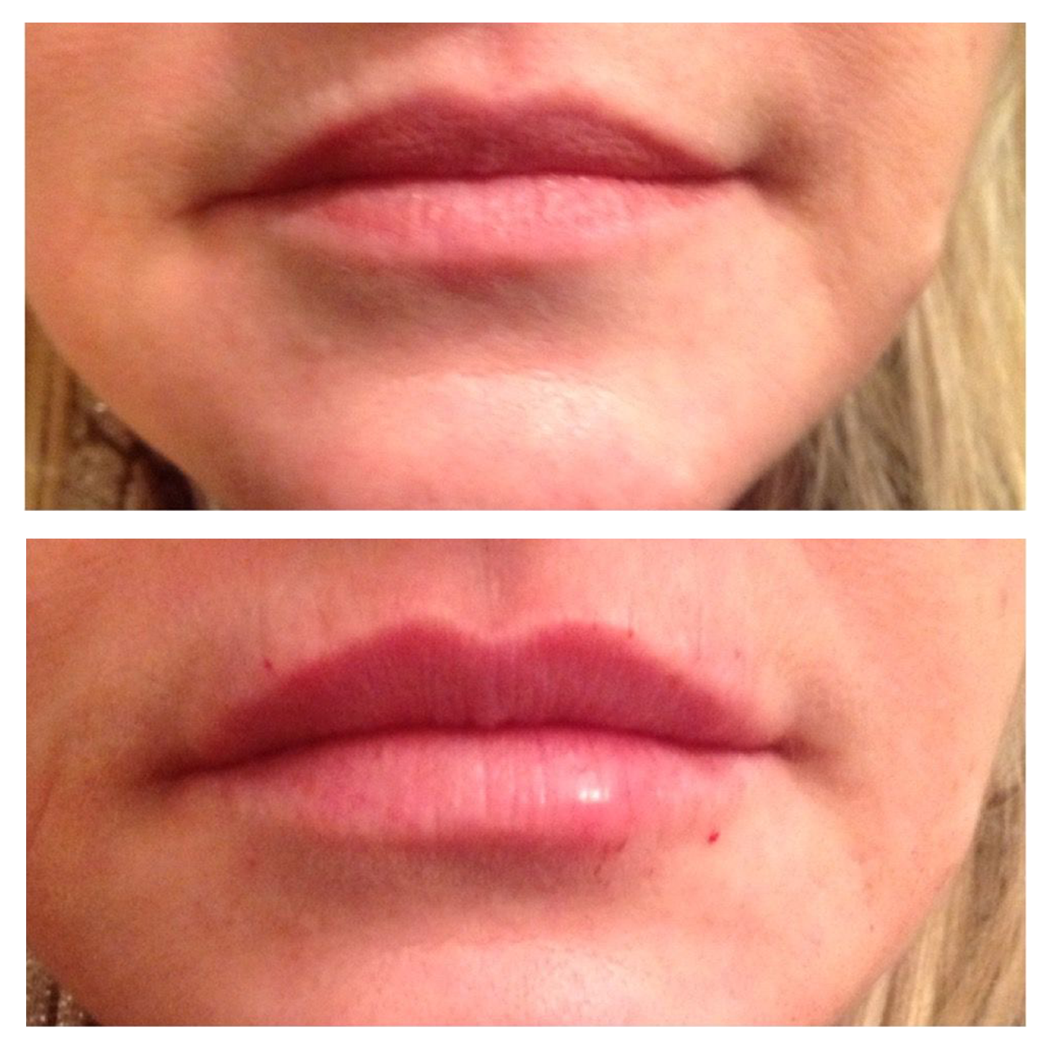 BEFORE & AFTER 3.png