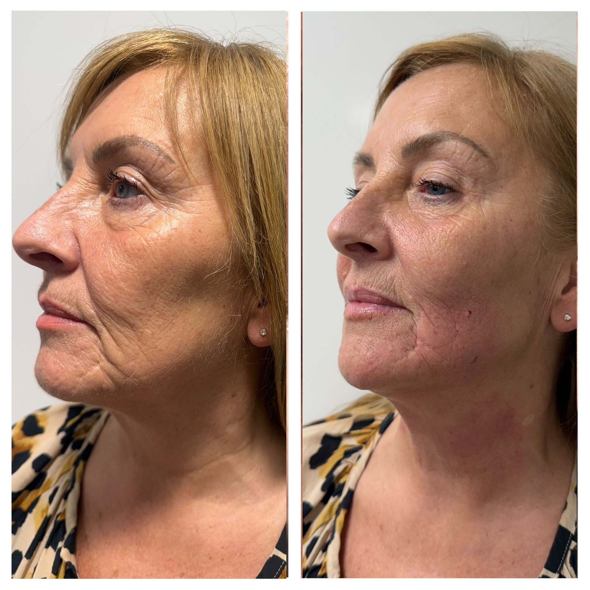 BEFORE & AFTER 1.png