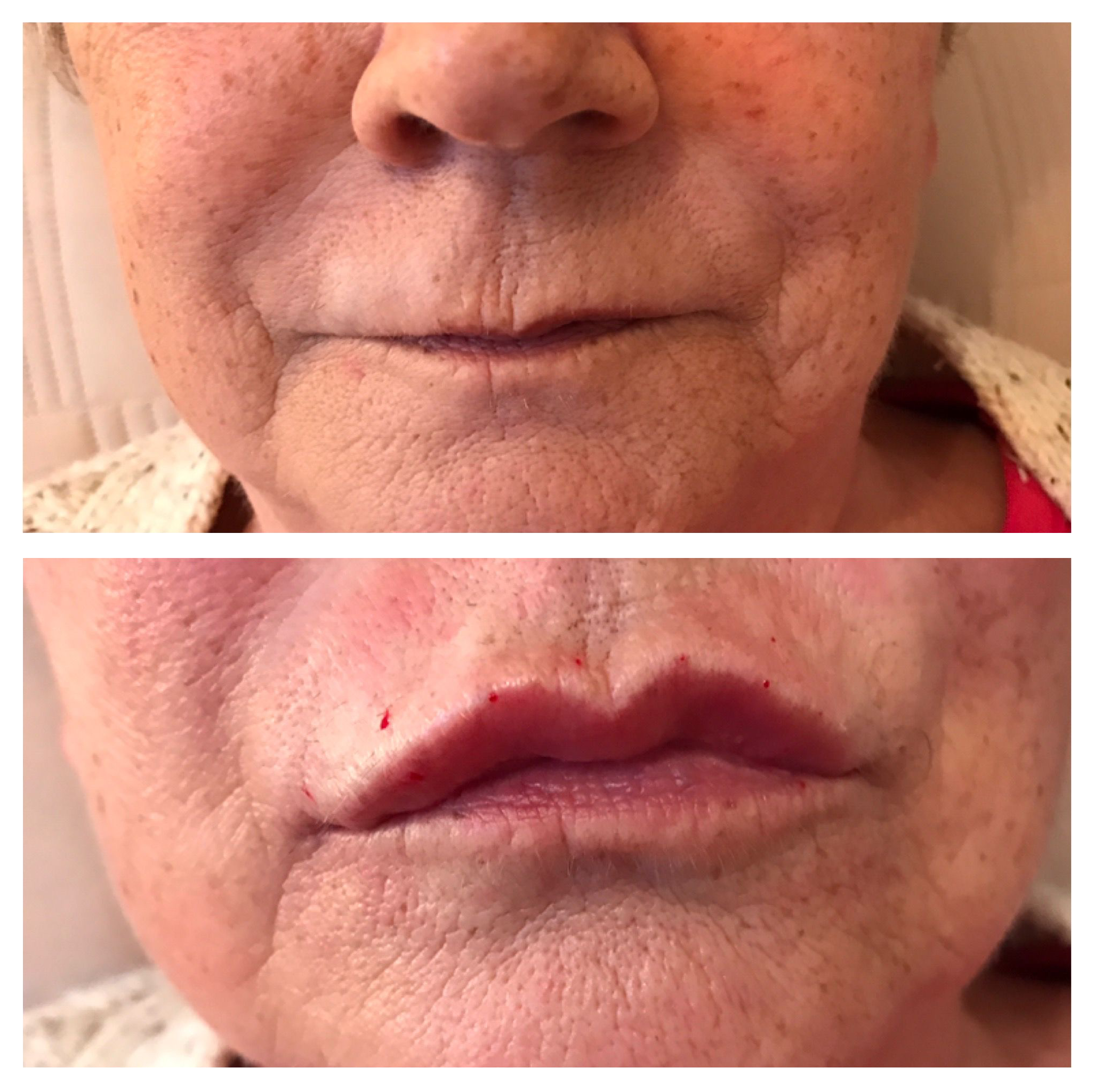 BEFORE & AFTER 4.png