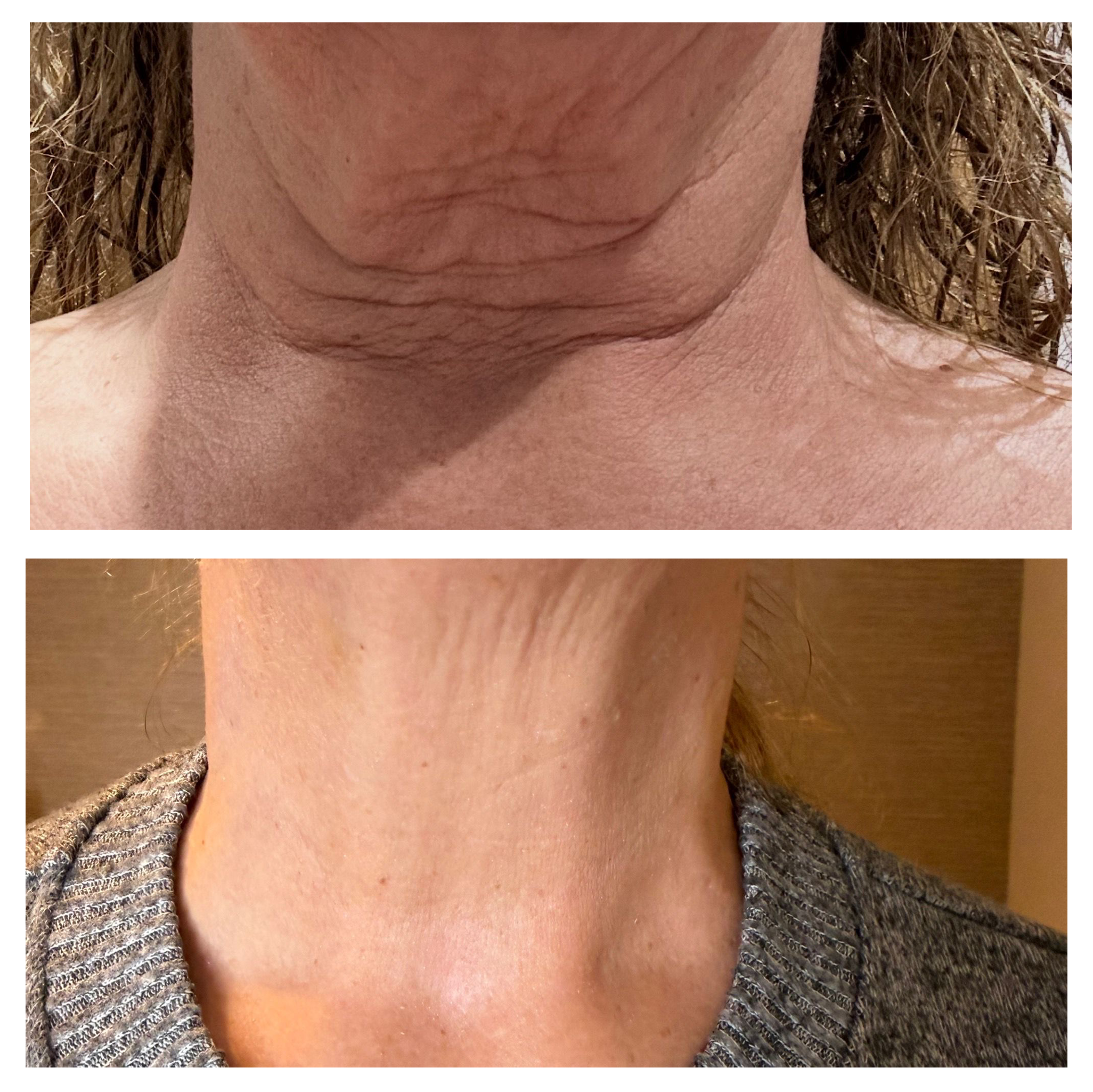 BEFORE & AFTER 5.png