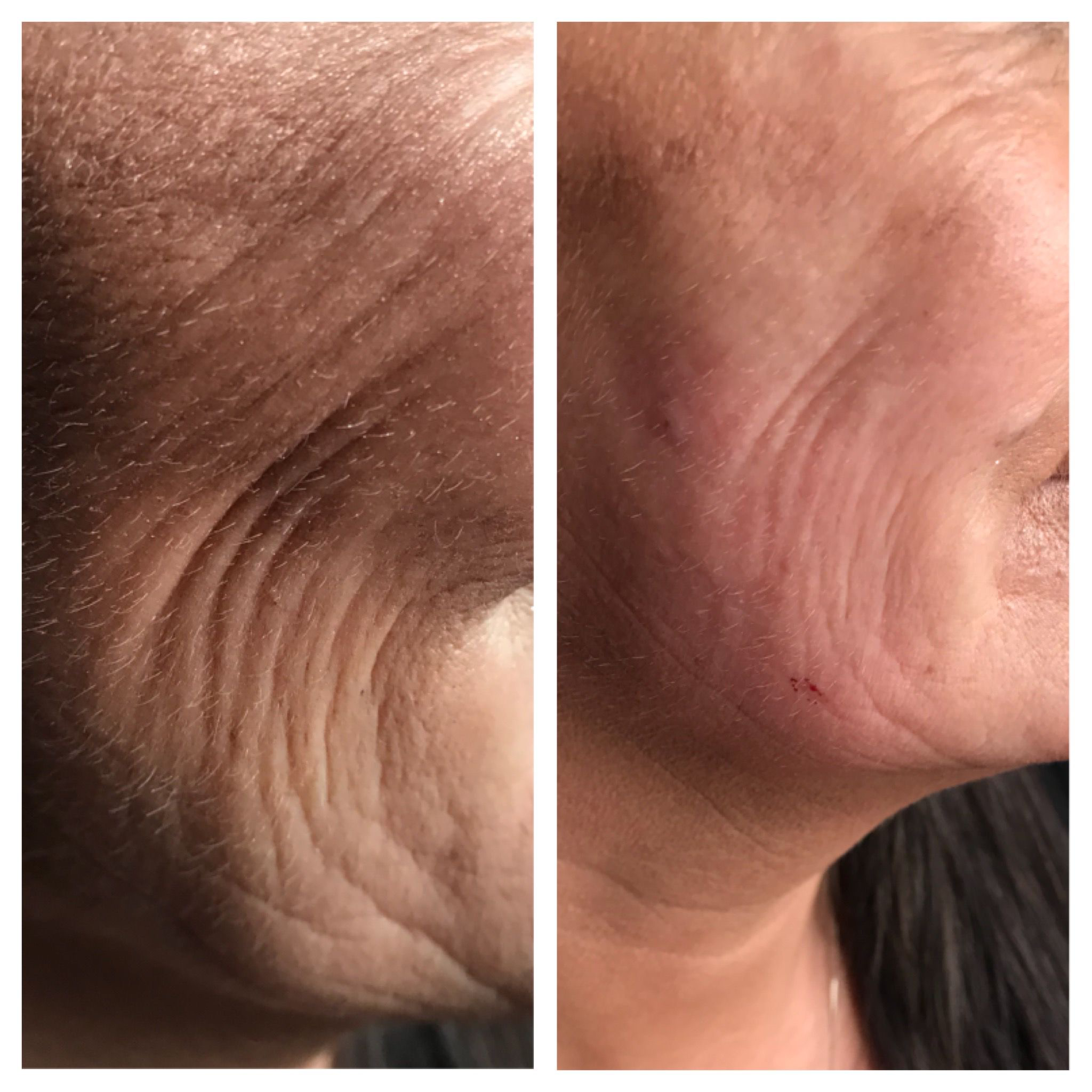 BEFORE & AFTER 2.png