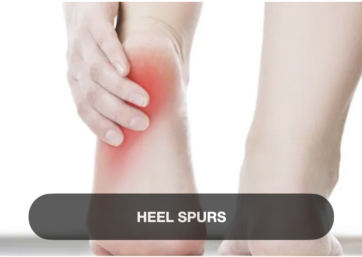 A person holding their ankle with redness and pain, indicating heel spurs.