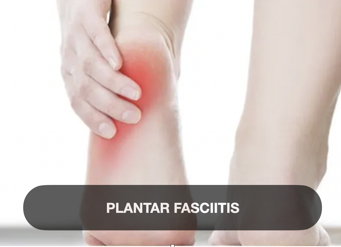 Person holding their lower leg, indicating heel pain, with red highlighting on the heel area. The image caption reads 'PLANTAR FASCIITIS'.