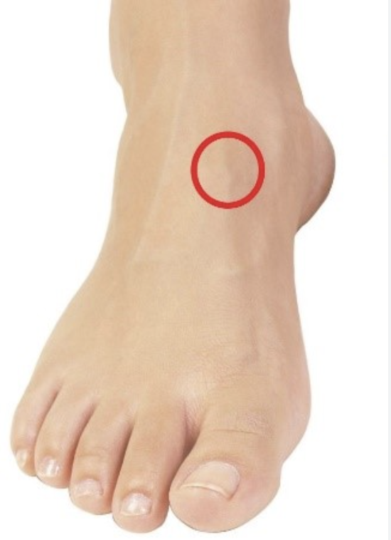 A human foot with a red circle drawing around a specific area near the ankle.