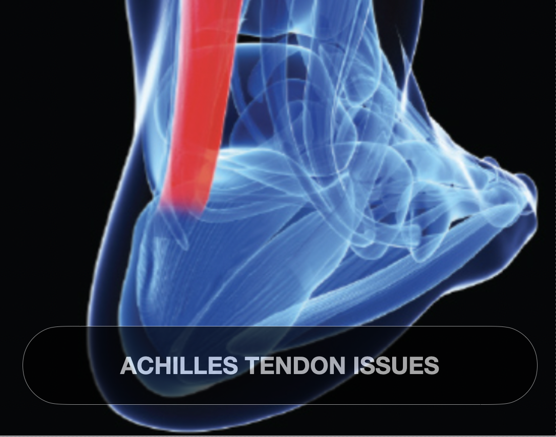 Medical illustration showing Achilles tendon issue in the foot with red highlight on the tendon.