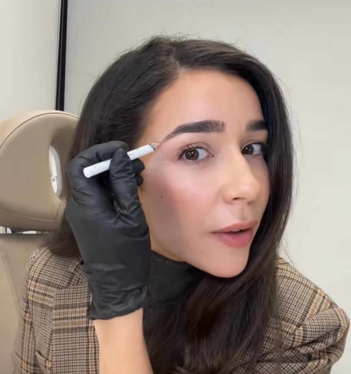 My Approach to Natural Crow’s Feet Botox