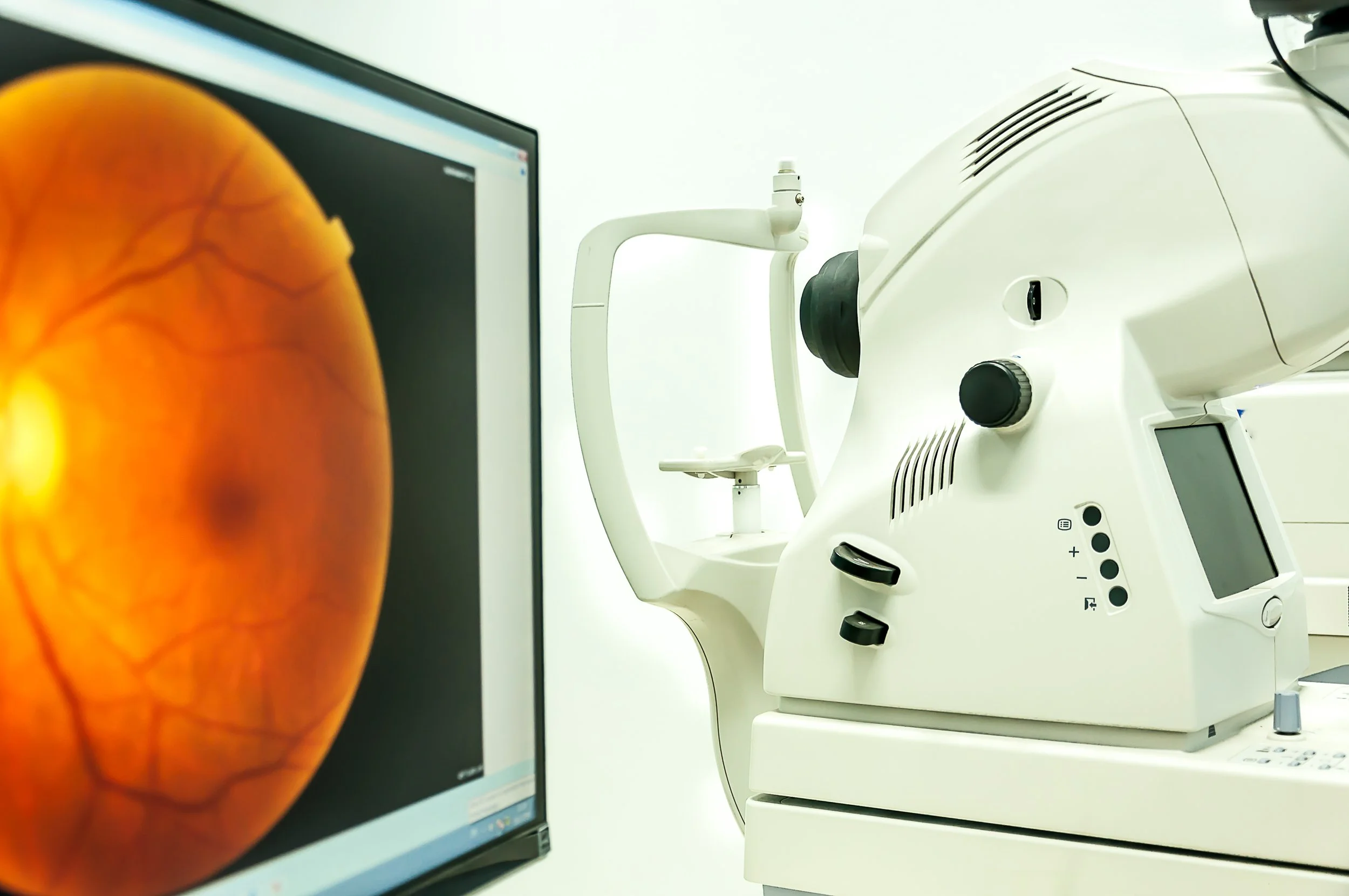 A medical retina examination with an optical coherence tomography (OCT) machine and a monitor displaying an eye scan.