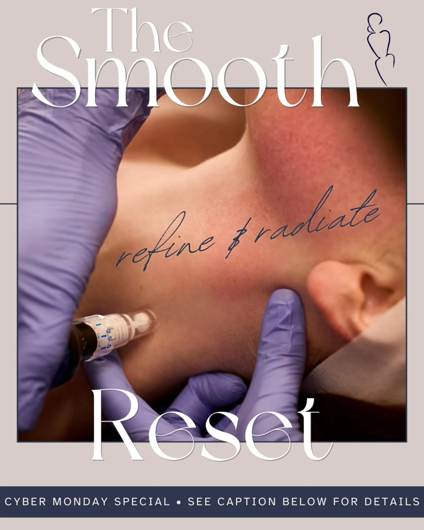 The Smooth Reset &mdash; Your CYBER MONDAY Deal for Silky, Refined Skin!

✨ SkinPen Face/Neck Package (x3) &mdash; $840 ➕ TWO Customized Facials for the Price of ONE! 

Total Package: $990 &bull; Save $360

&nbsp;
What It Does

&nbsp;

SkinPen (Face 