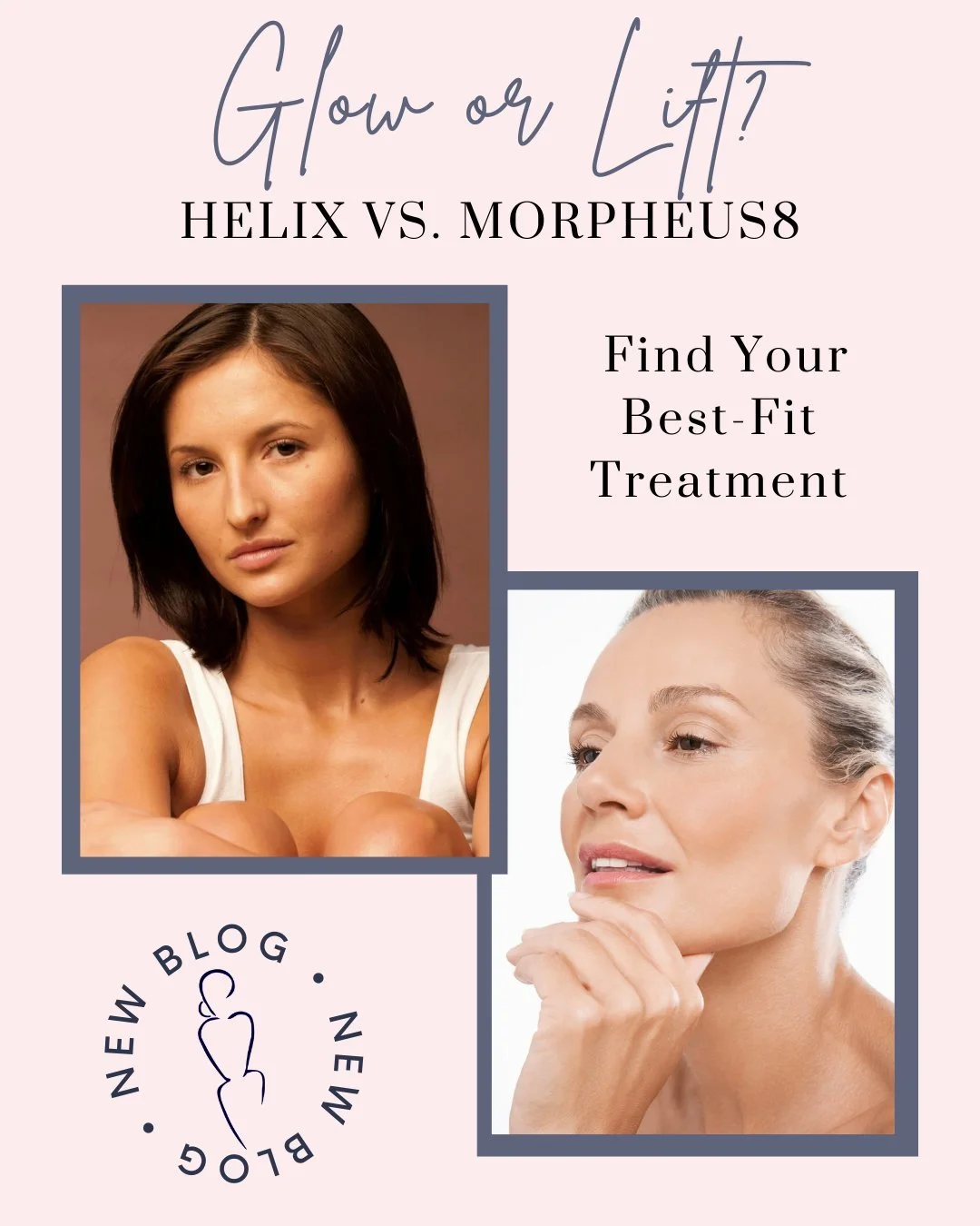 Helix or Morpheus8&mdash;it isn&rsquo;t about which treatment is better, it&rsquo;s about what your skin needs most.

If you&rsquo;re focused on brightness and texture, Helix may be your match.

If you&rsquo;re looking for lift and tightening, Morphe