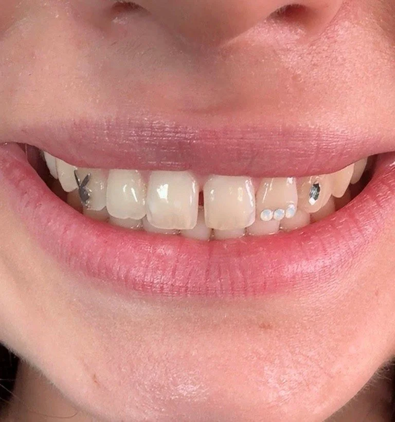 tooth gem2.jpg