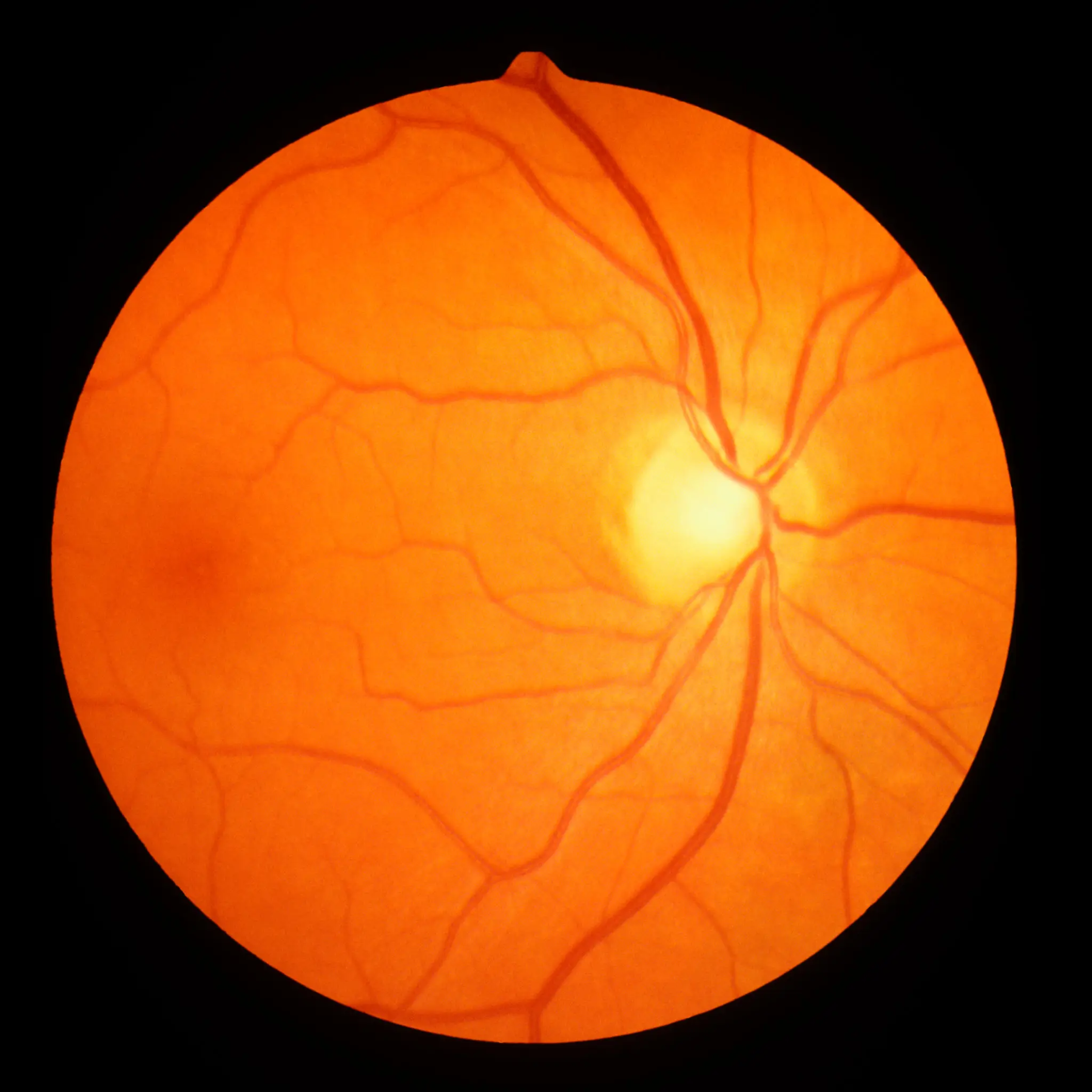 What Is Retinal Imaging? Why It Matters for Your Eye Health in South Ogden and Washington Terrace
