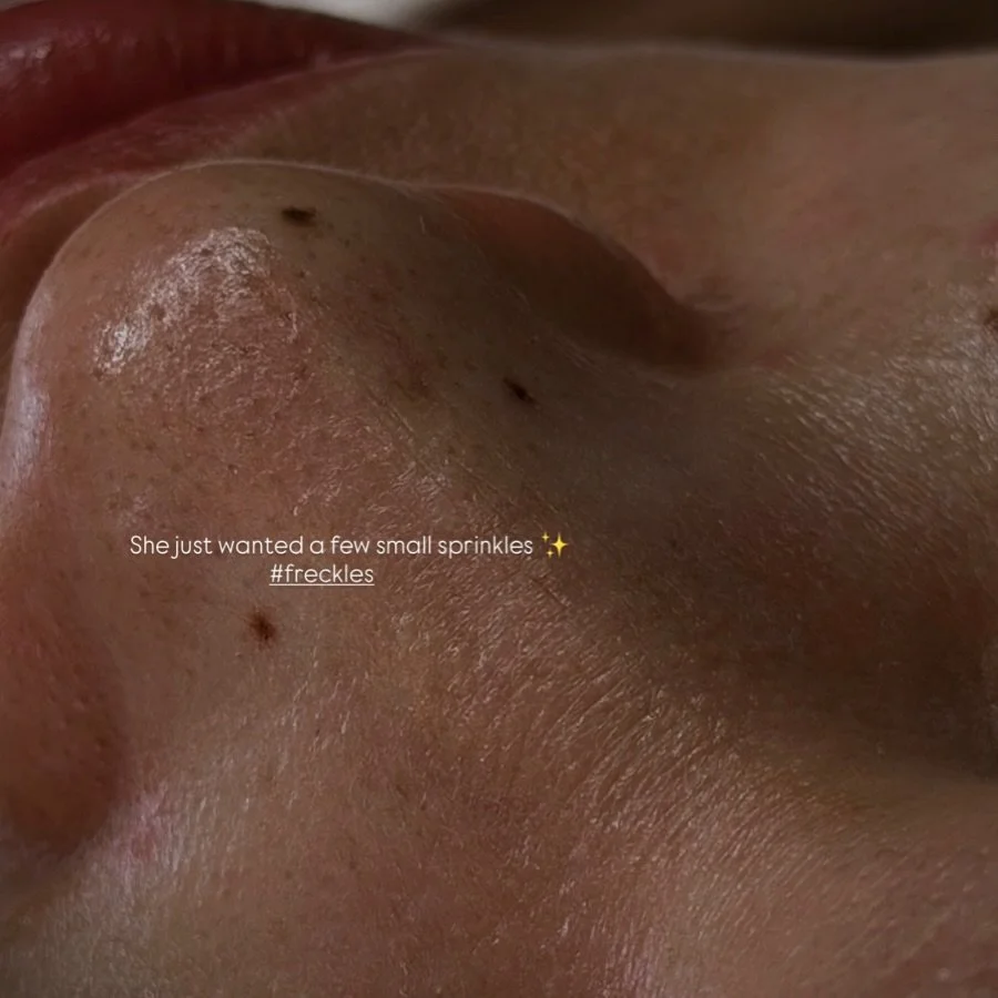 Freckles ✨ Freckles ✨Artist Danny 

#freckles