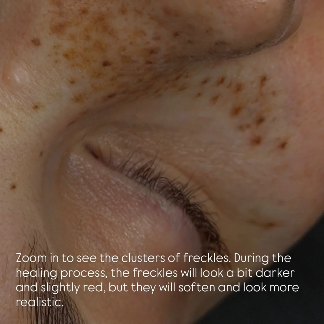 Sun-kissed ✨☀️

Artist @dannysimonyi