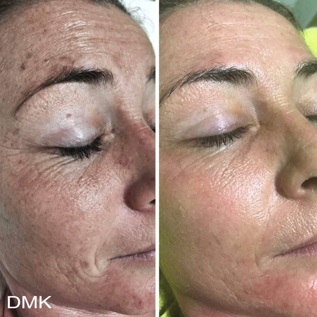 Perimenopause + Menopause + your skin 💫

Noticing dryness, sensitivity, dullness or unexpected breakouts?Hormonal changes can significantly impact how your skin looks and feels.

During this stage, skin often experiences:
🍃Collagen decline
🍃Dehydr