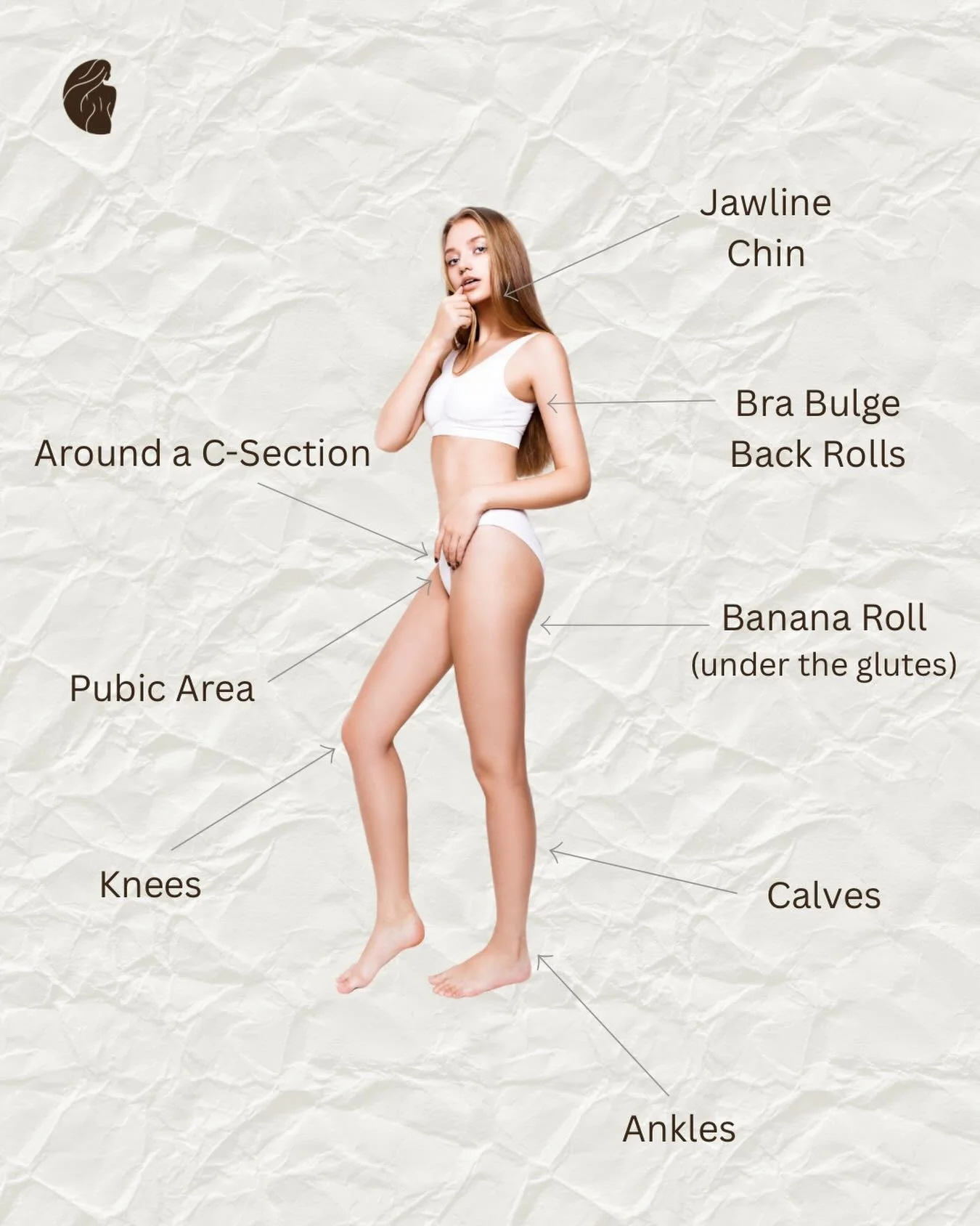 Many people think liposuction is only for the abdomen or thighs&hellip; but that&rsquo;s not the case.

Liposuction can be performed in smaller, often overlooked areas like:

&bull; Chin &amp; jawline
&bull; Upper arms
&bull; Bra bulge &amp; back rol