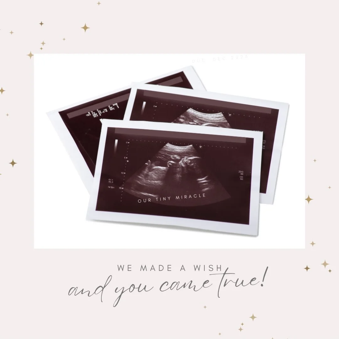 After the storm, our rainbow. We never thought we&rsquo;d get here, but here you are 🤍worth every moment of waiting, every prayer, every tear. Our hearts are finally whole. Coming July.