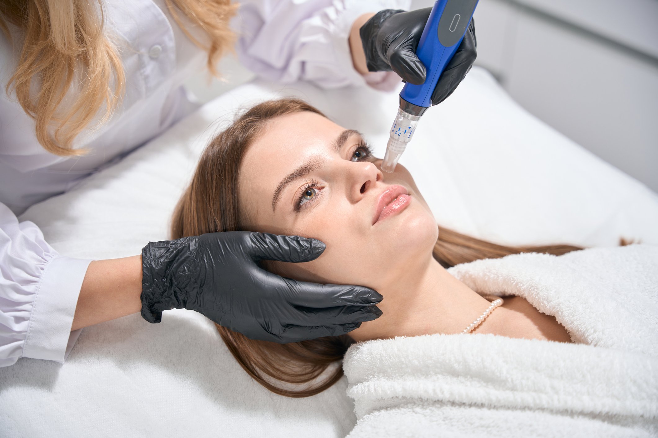 A woman lying down on a white treatment bed during a cosmetic procedure, with a healthcare professional administering a treatment to her face with a SkinPen device. The healthcare professional is wearing black gloves and a white coat.