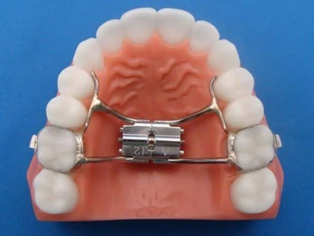 Orthodontic Appliances