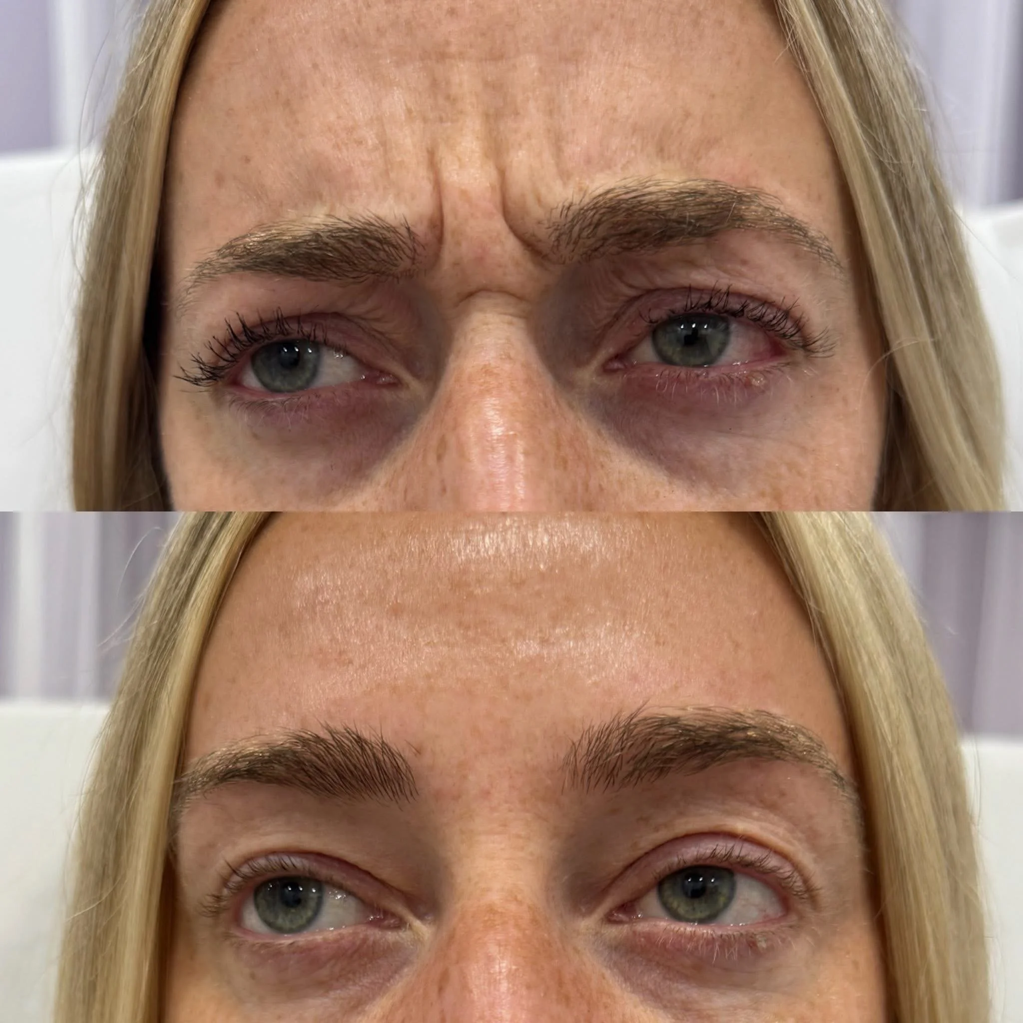 Close-up of a woman's face, showing a before and after comparison of her eyebrows, with the after image displaying fuller, well-groomed eyebrows.