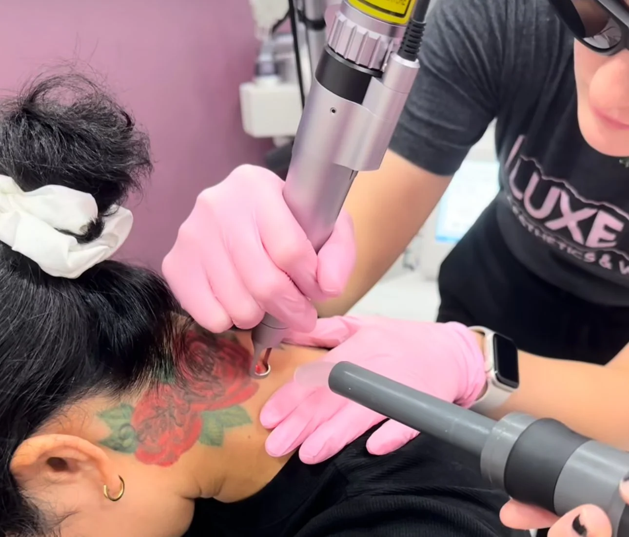 A person receiving tattoo removal treatment on their neck area from a technician using a laser device, with the person wearing pink gloves and the technician in glasses.