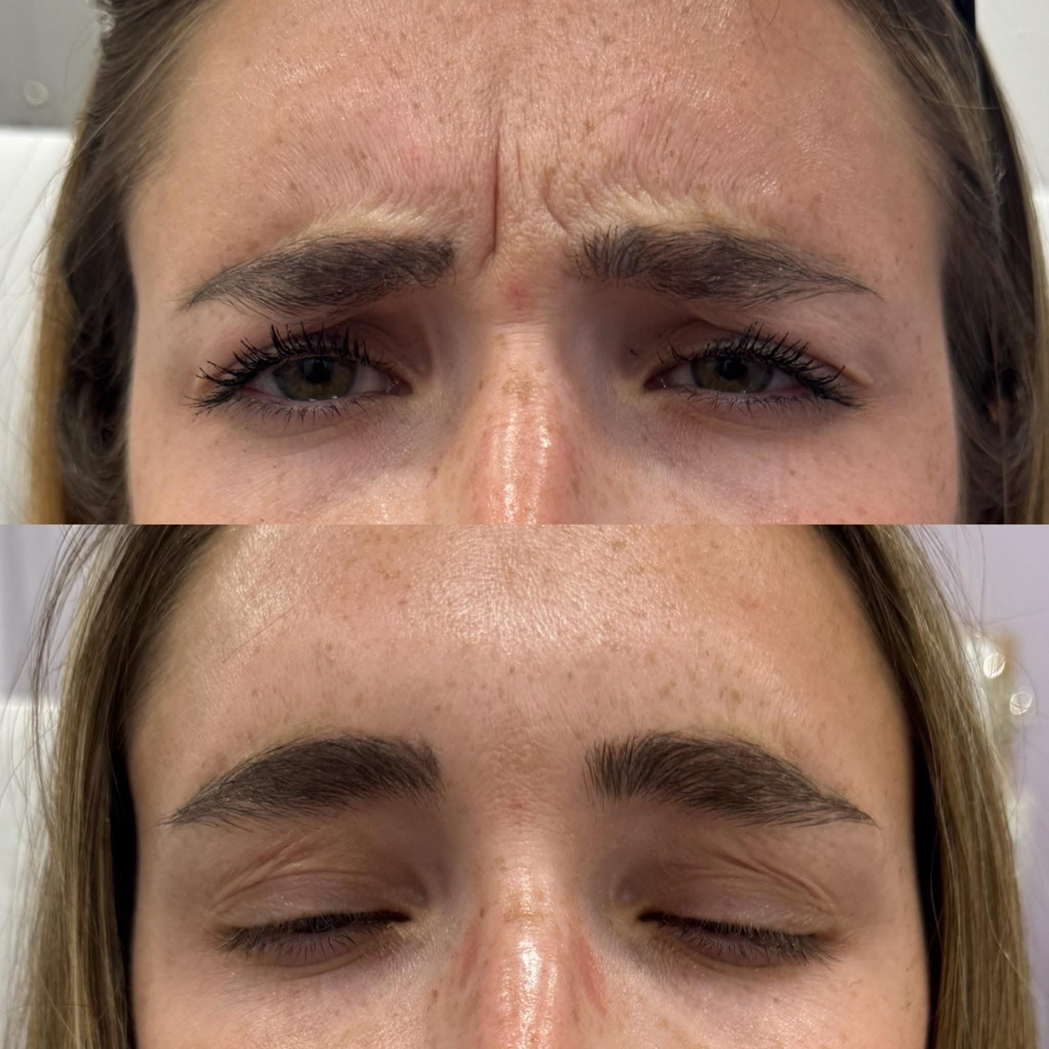 Close-up of woman’s face before and after eyebrow microblading treatment, top image shows natural eyebrows, bottom image shows filled-in eyebrows with a natural look.