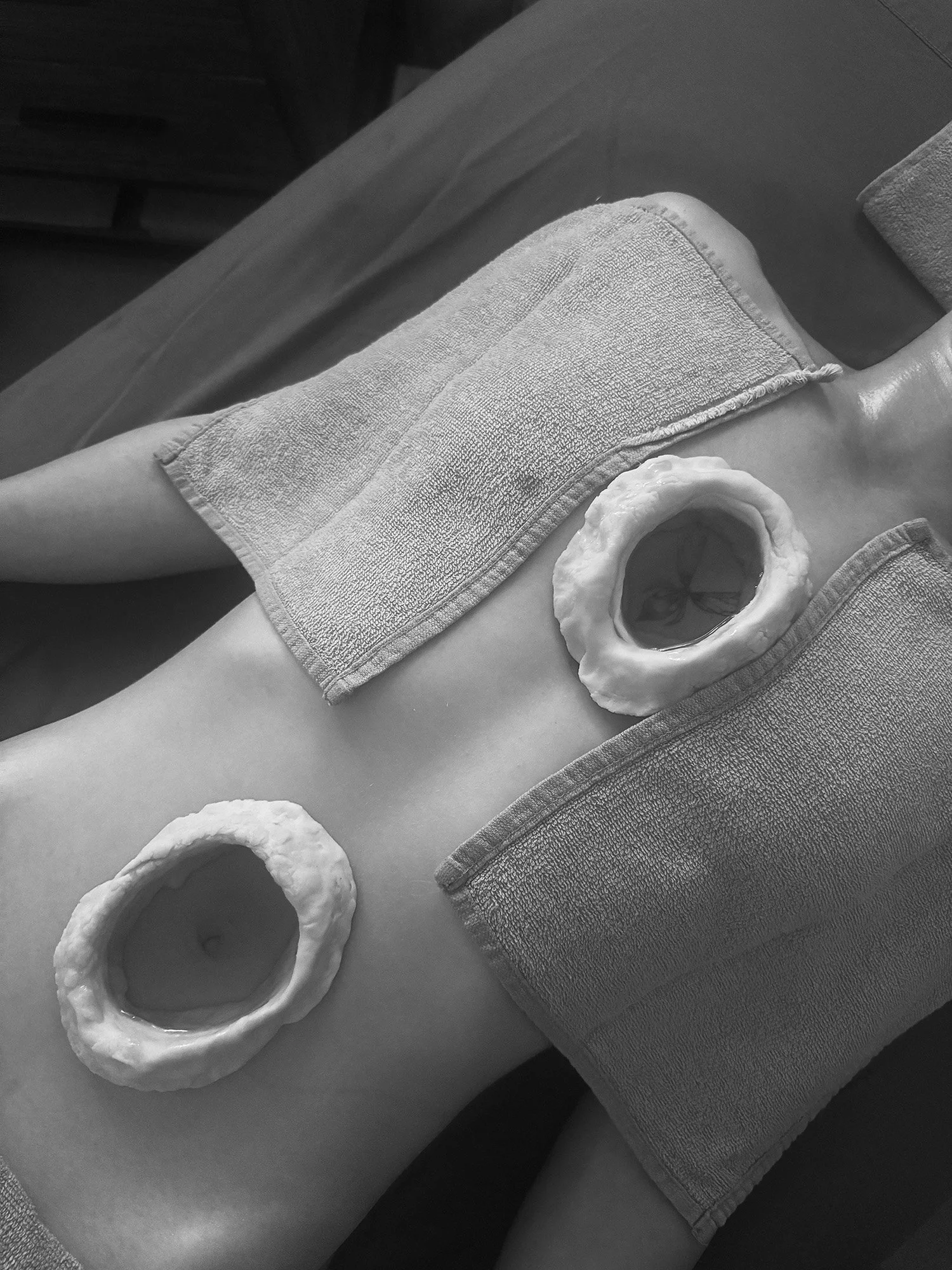 A person lying face up on a table with two textured circular objects placed on their stomach, filled with oil. The image is in black and white.