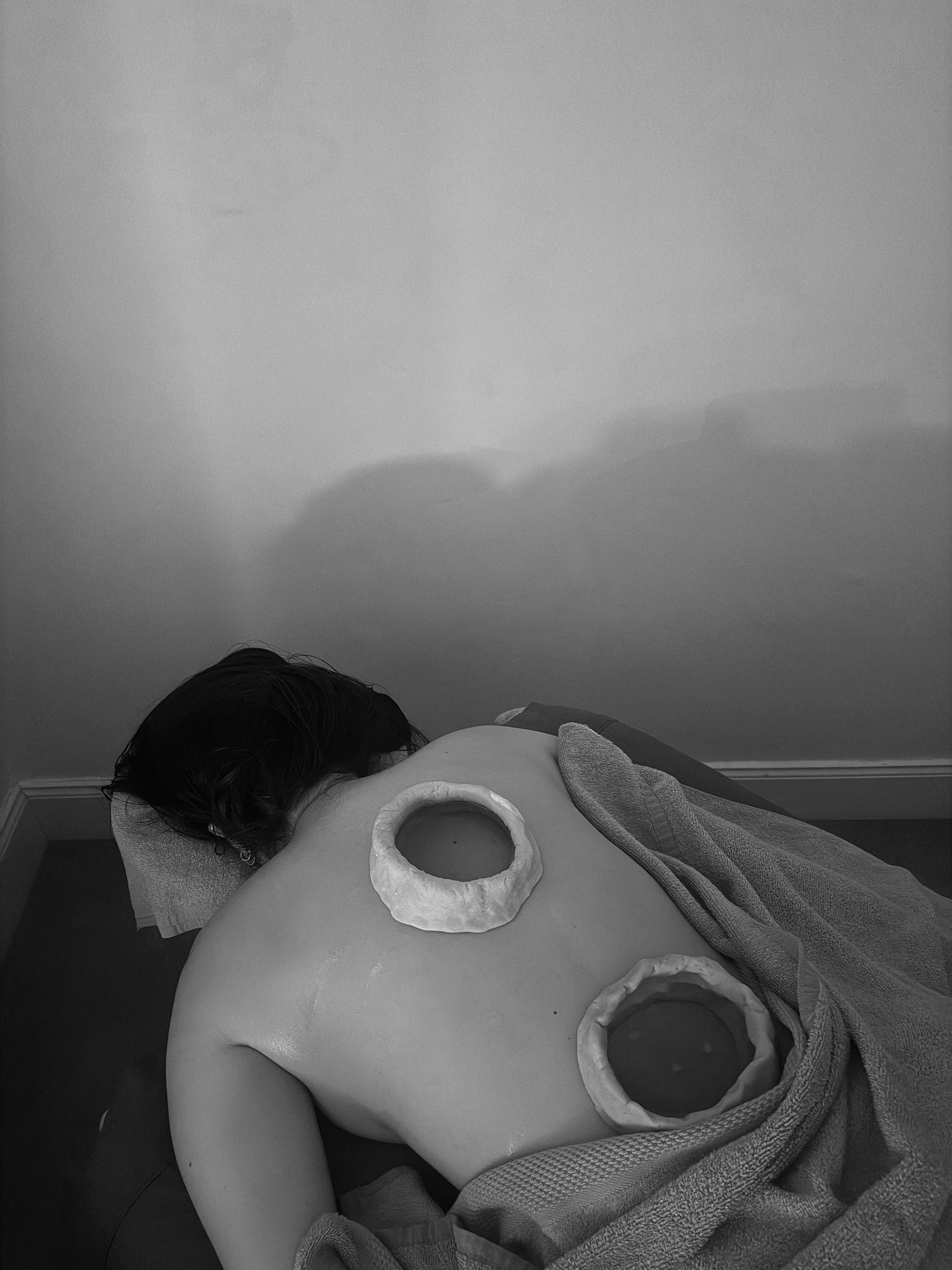 A person lying face down on a massage table with two circular objects placed on their back, filled with oil. The image is in black and white.