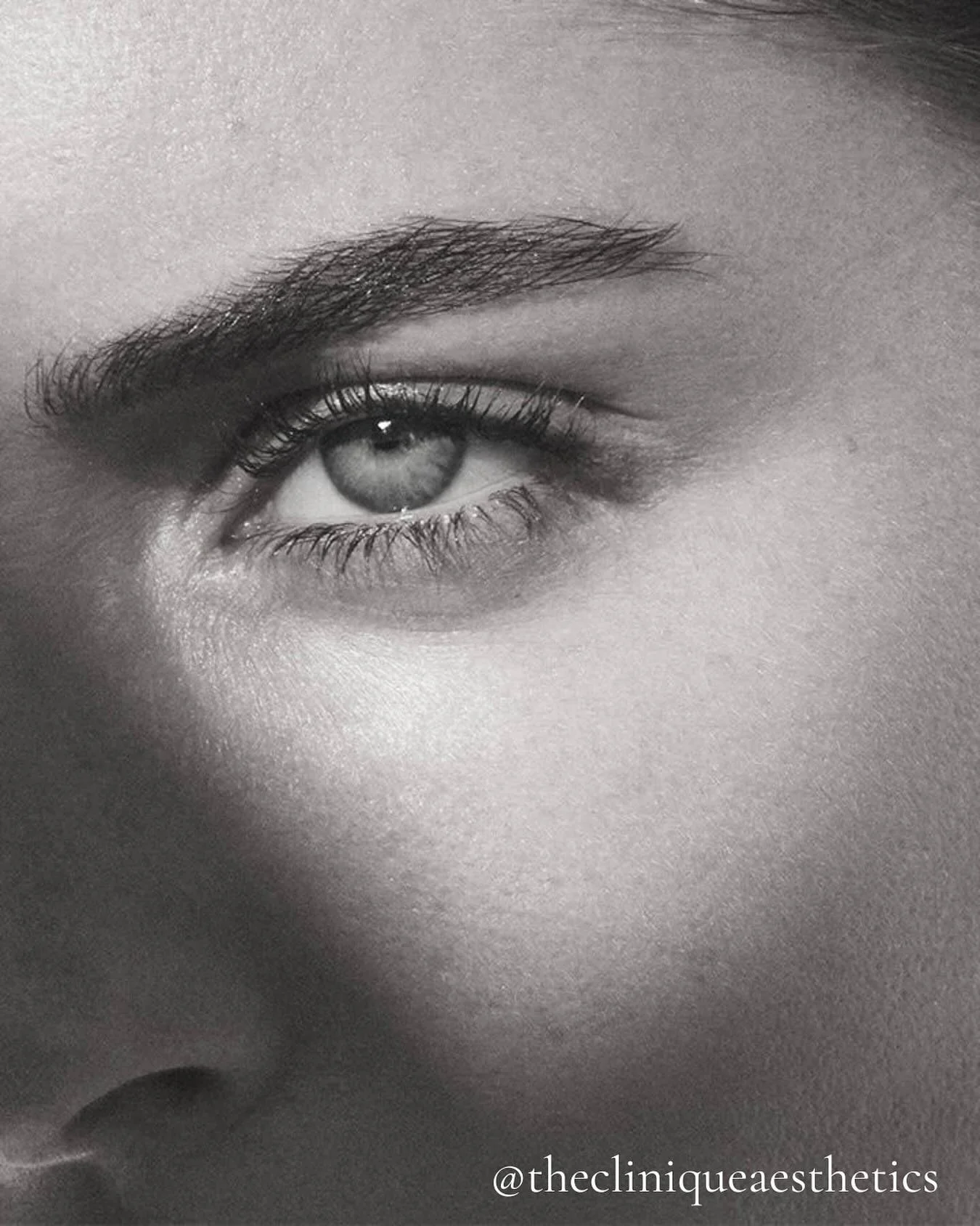 The team @thecliniqueaesthetics are excited to share that we are now introducing Rejuran I to our treatment menu

It&rsquo;s designed to support the delicate under-eye area and enhance overall skin quality

If you&rsquo;re exploring options to refres