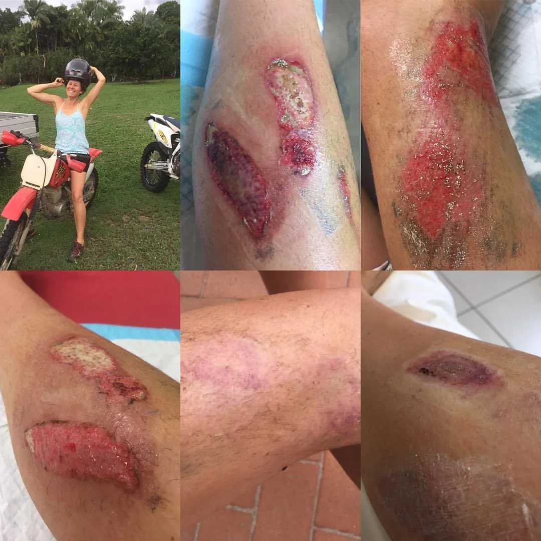 What I Learnt From My Accident